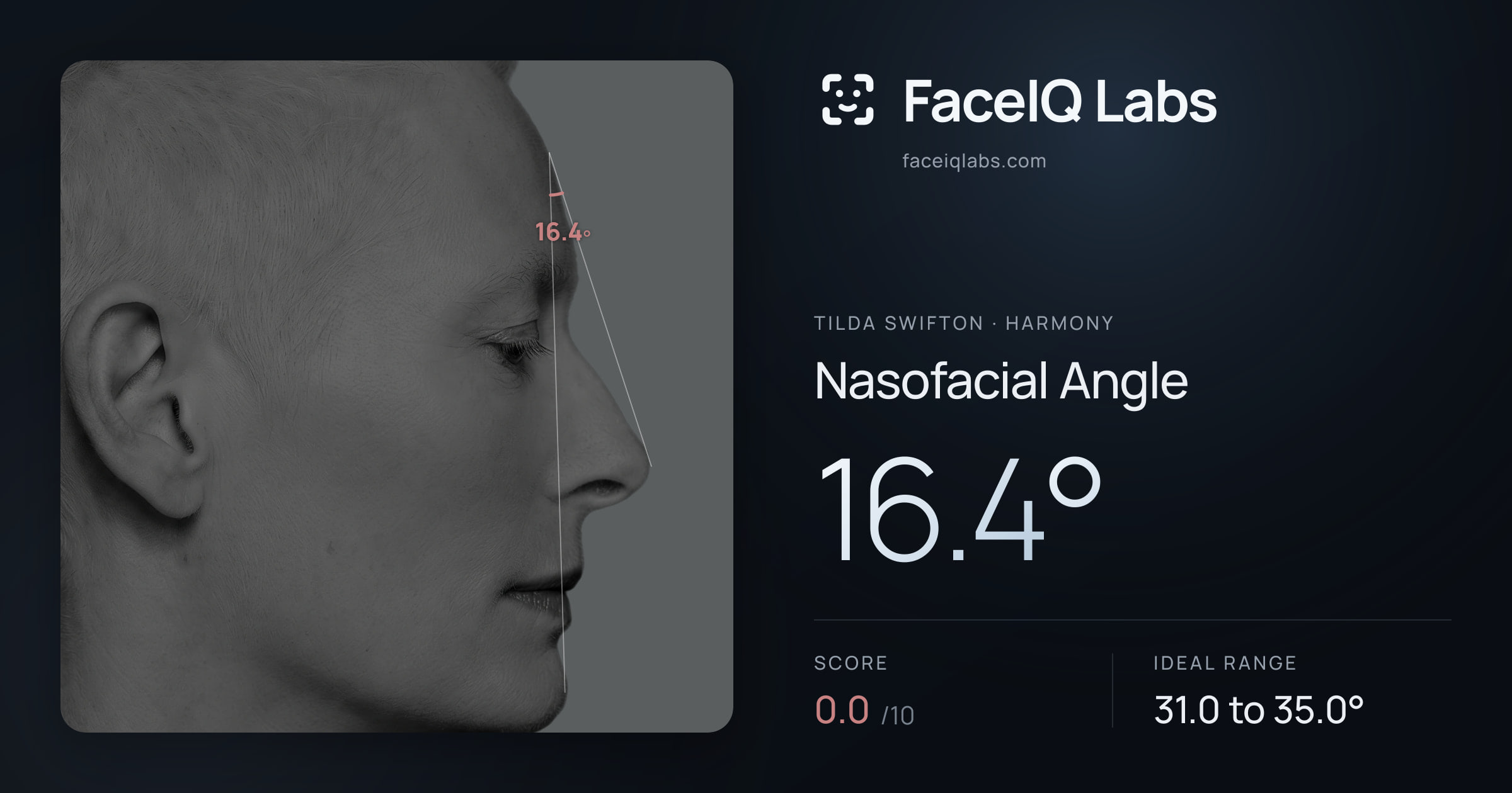 Tilda Swifton Nasofacial Angle: 16.4°, drawn on the photo