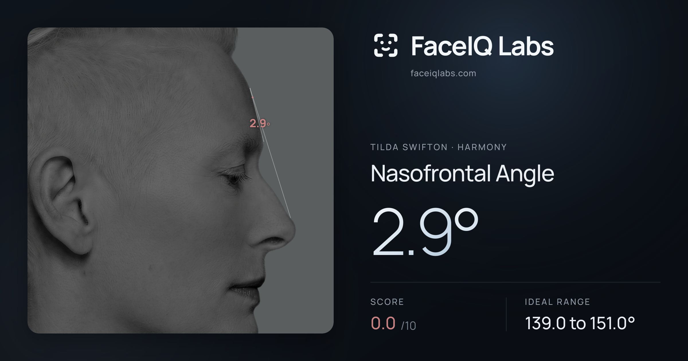 Tilda Swifton Nasofrontal Angle: 2.9°, drawn on the photo
