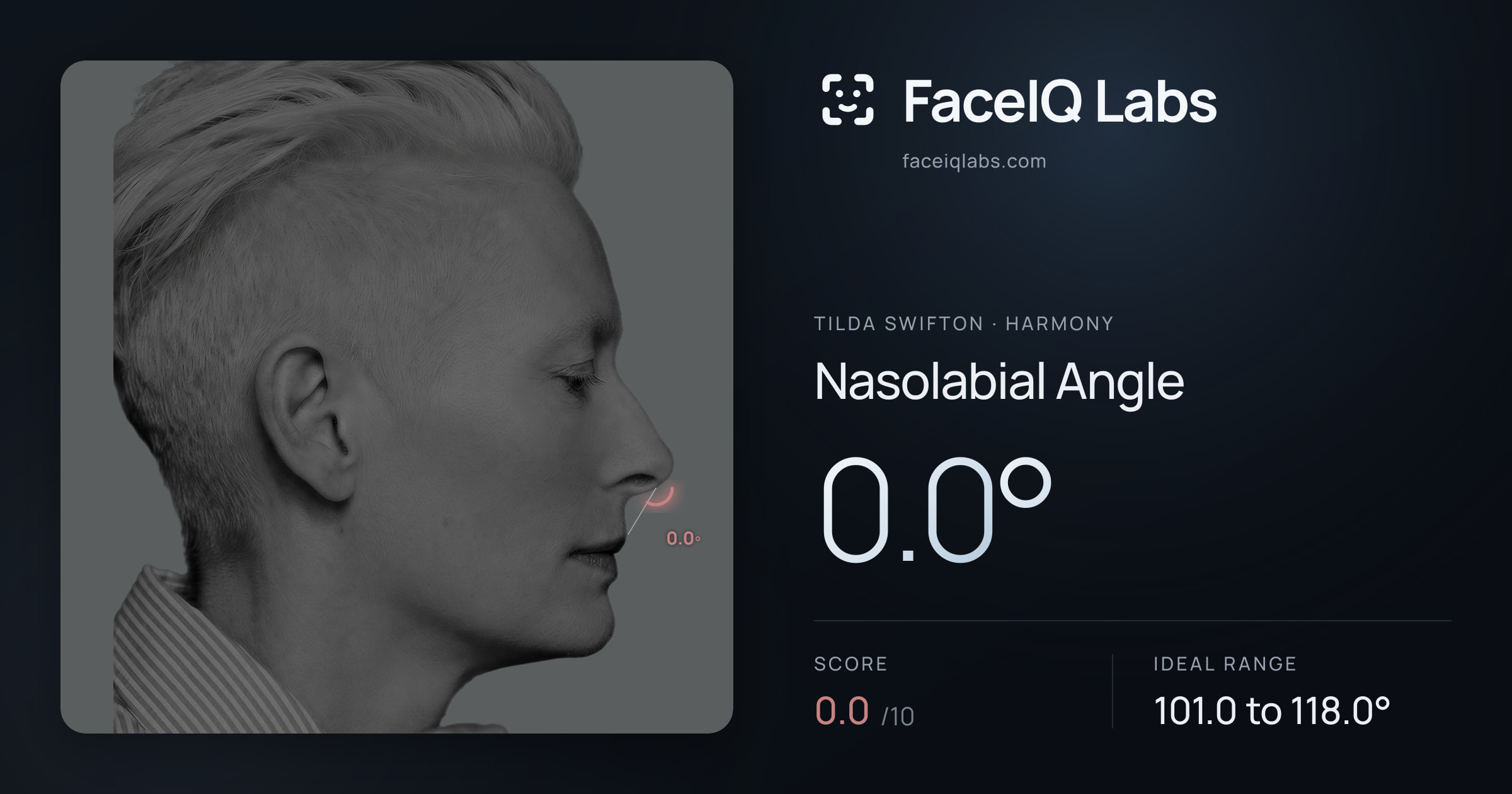 Tilda Swifton Nasolabial Angle: 0.0°, drawn on the photo