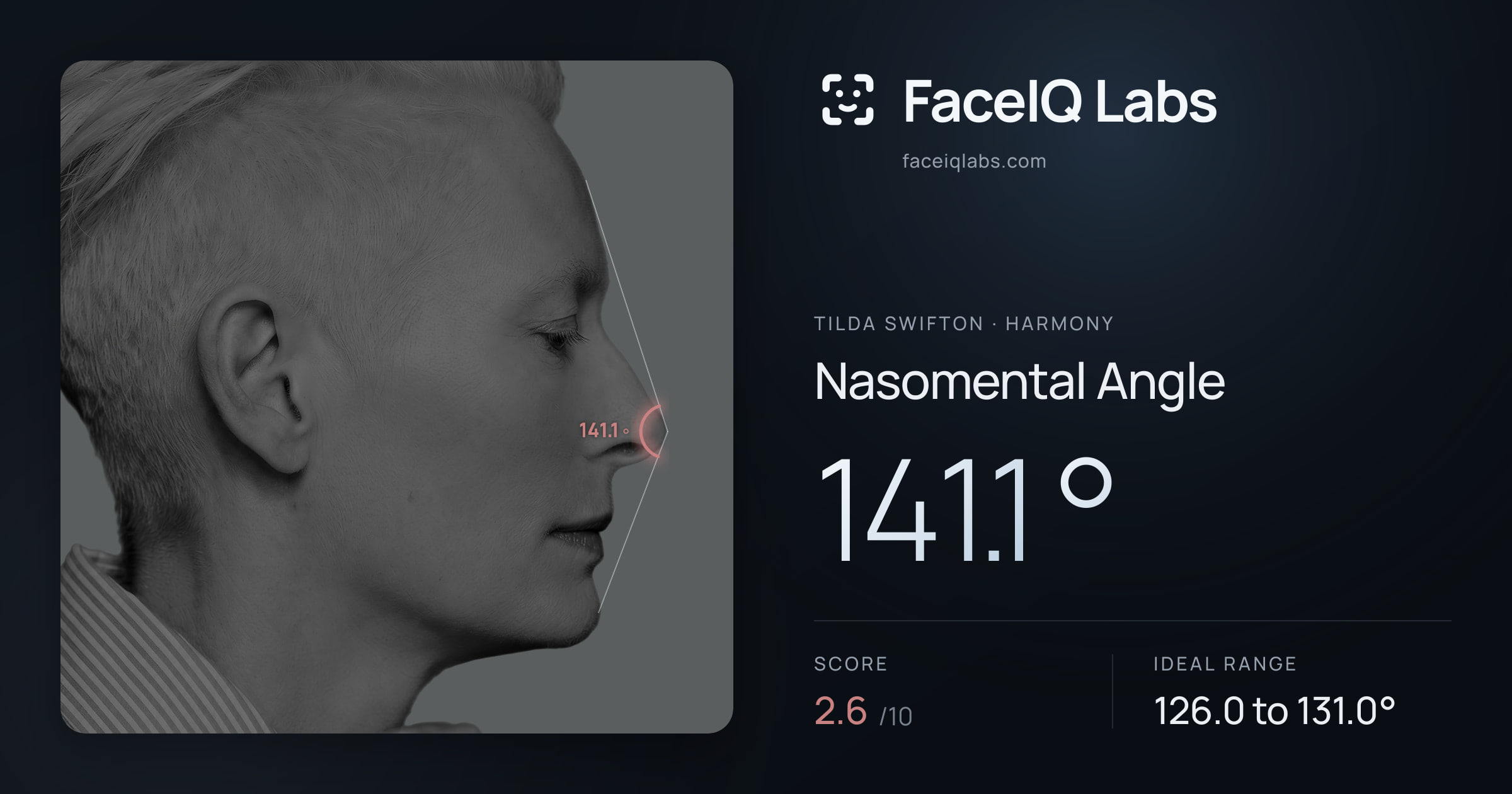 Tilda Swifton Nasomental Angle: 141.1°, drawn on the photo