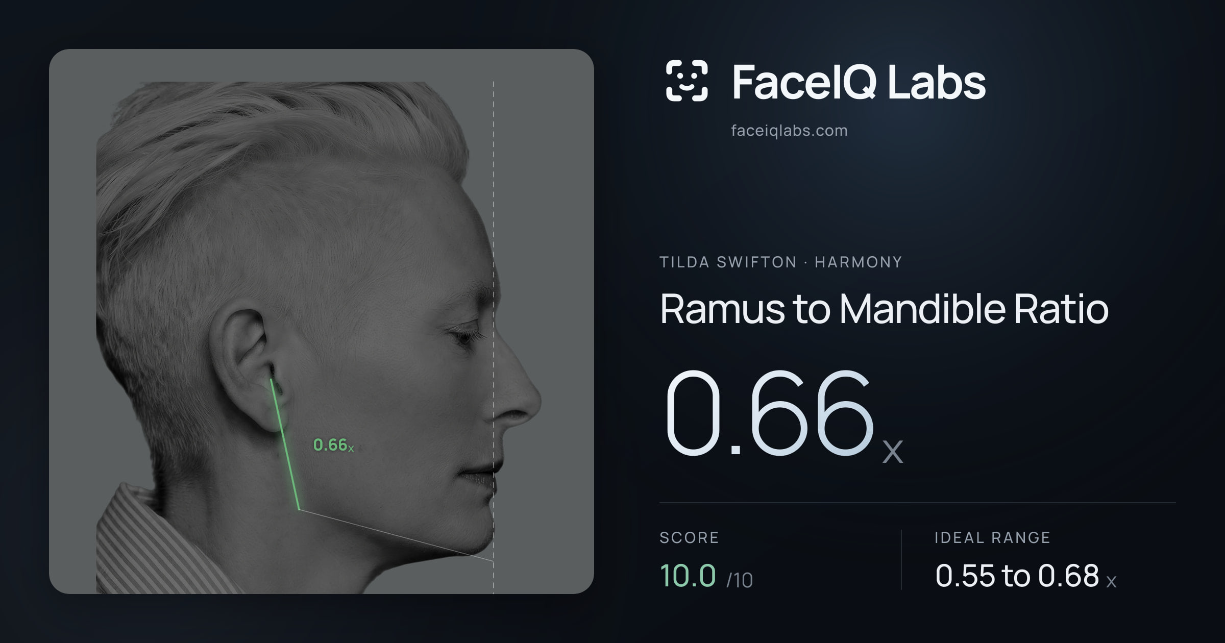 Tilda Swifton Ramus to Mandible Ratio: 0.66x, drawn on the photo
