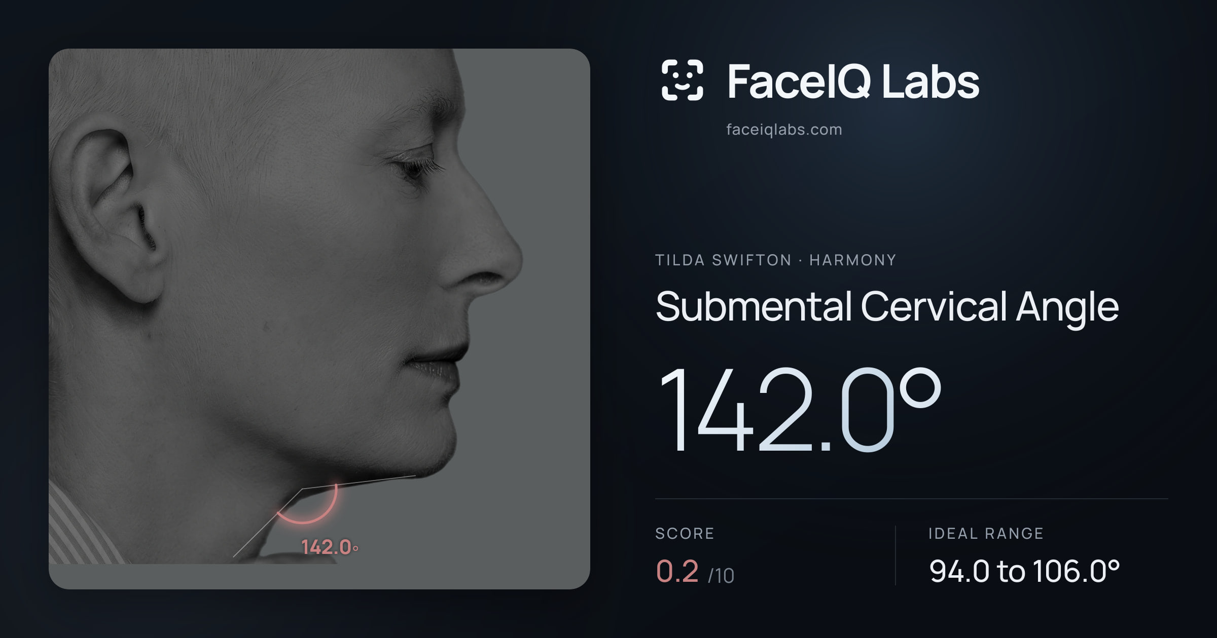 Tilda Swifton Submental Cervical Angle: 142.0°, drawn on the photo