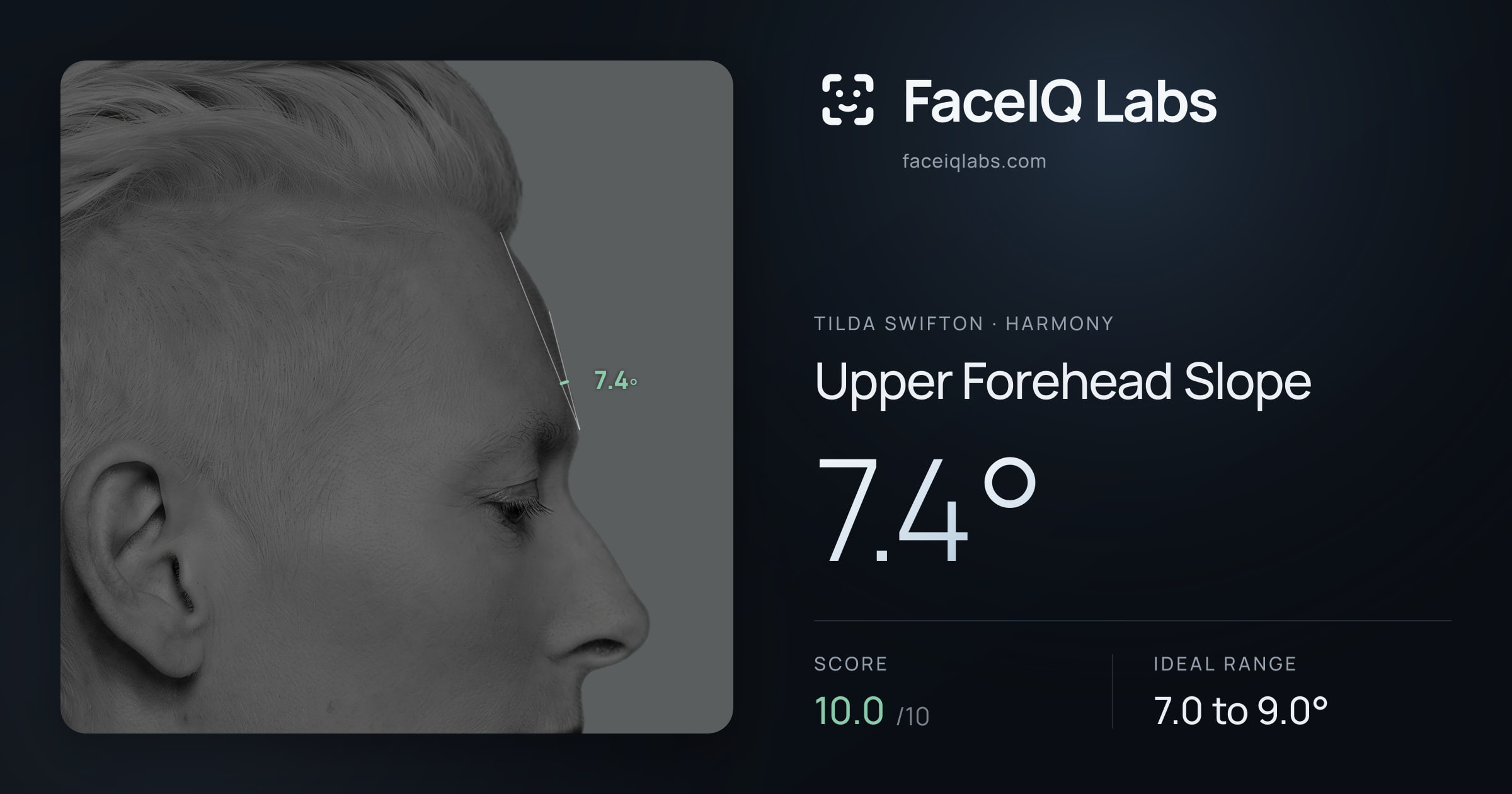 Tilda Swifton Upper Forehead Slope: 7.4°, drawn on the photo
