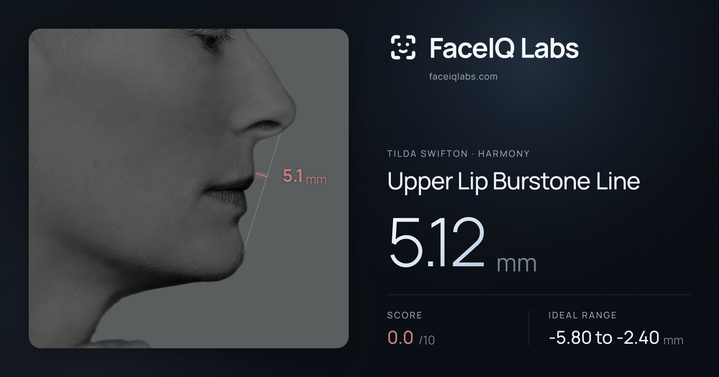 Tilda Swifton Upper Lip Burstone Line: 5.12mm, drawn on the photo