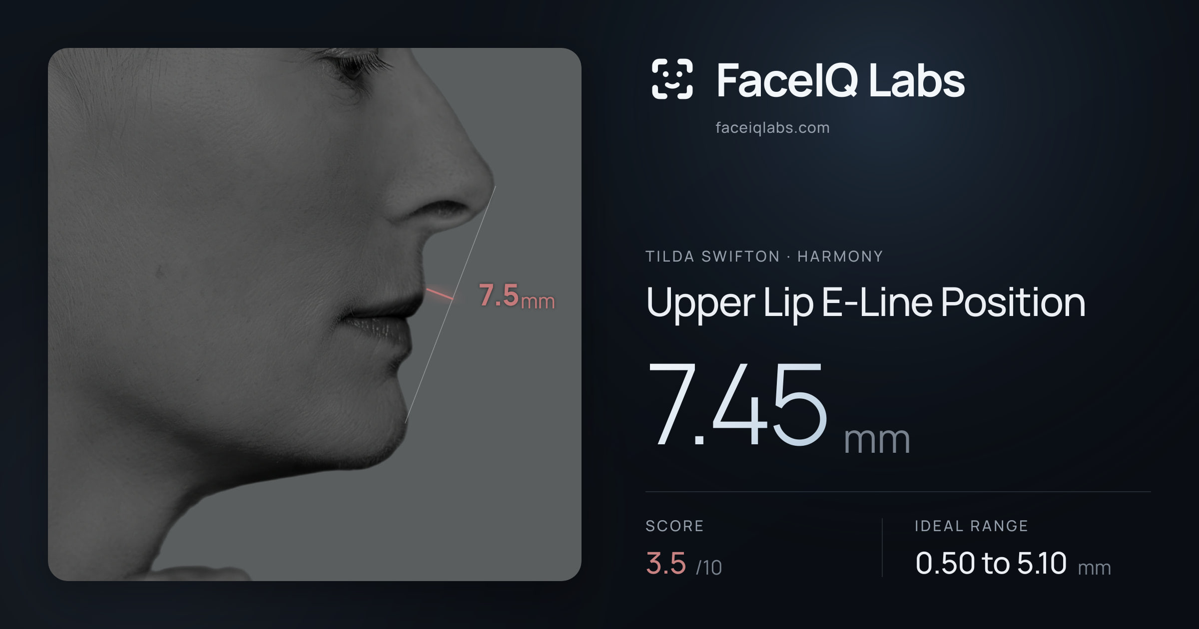 Tilda Swifton Upper Lip E-Line Position: 7.45mm, drawn on the photo