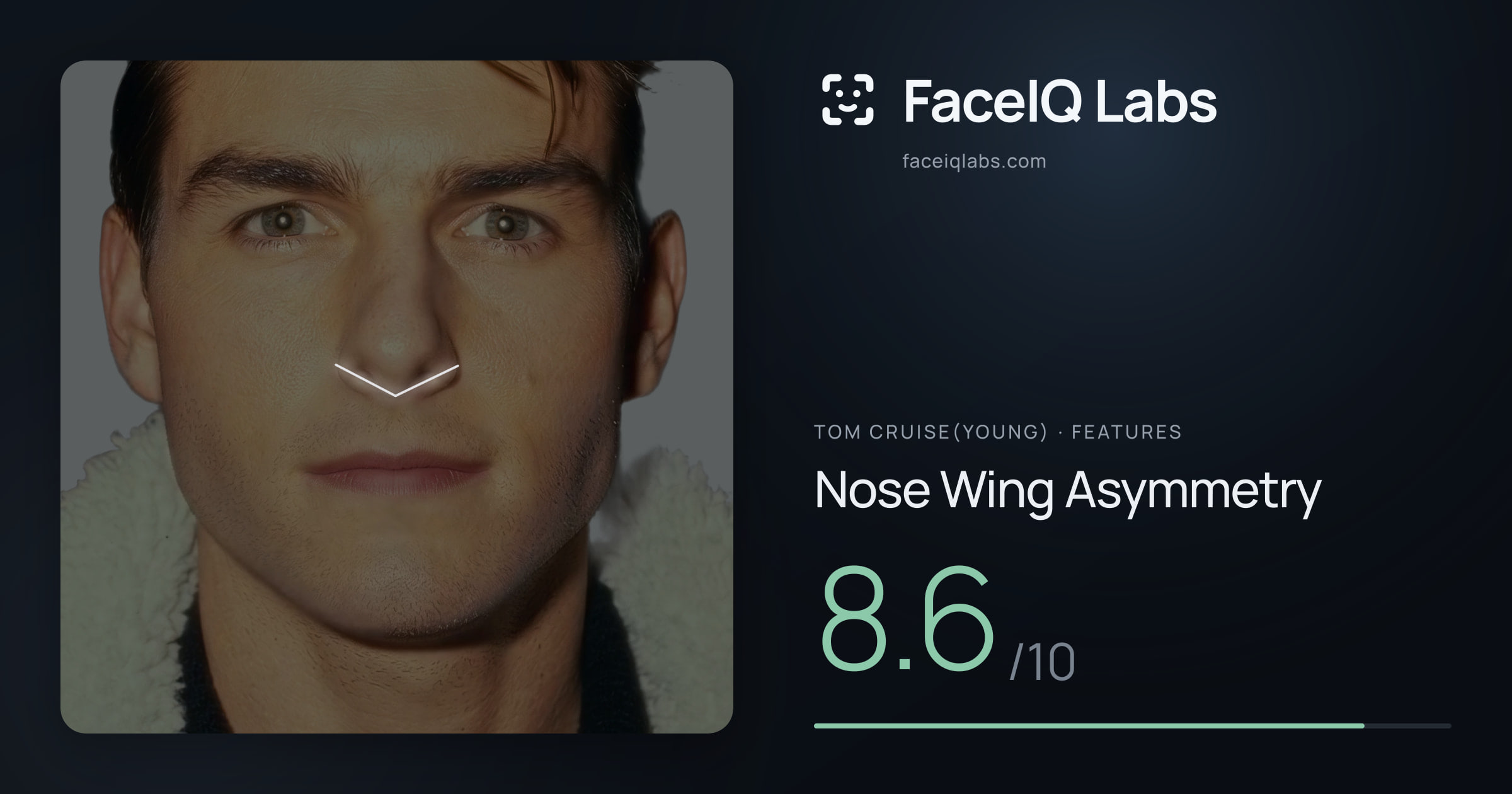 Tom Cruise(Young) Nose Wing Asymmetry: 8.6/10, drawn on the photo