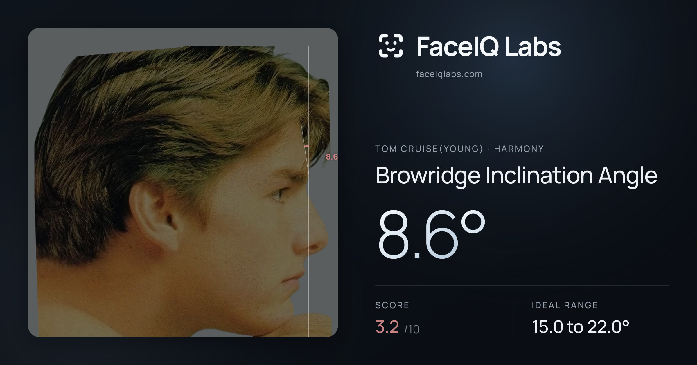 Tom Cruise(Young) Browridge Inclination Angle: 8.6°, drawn on the photo