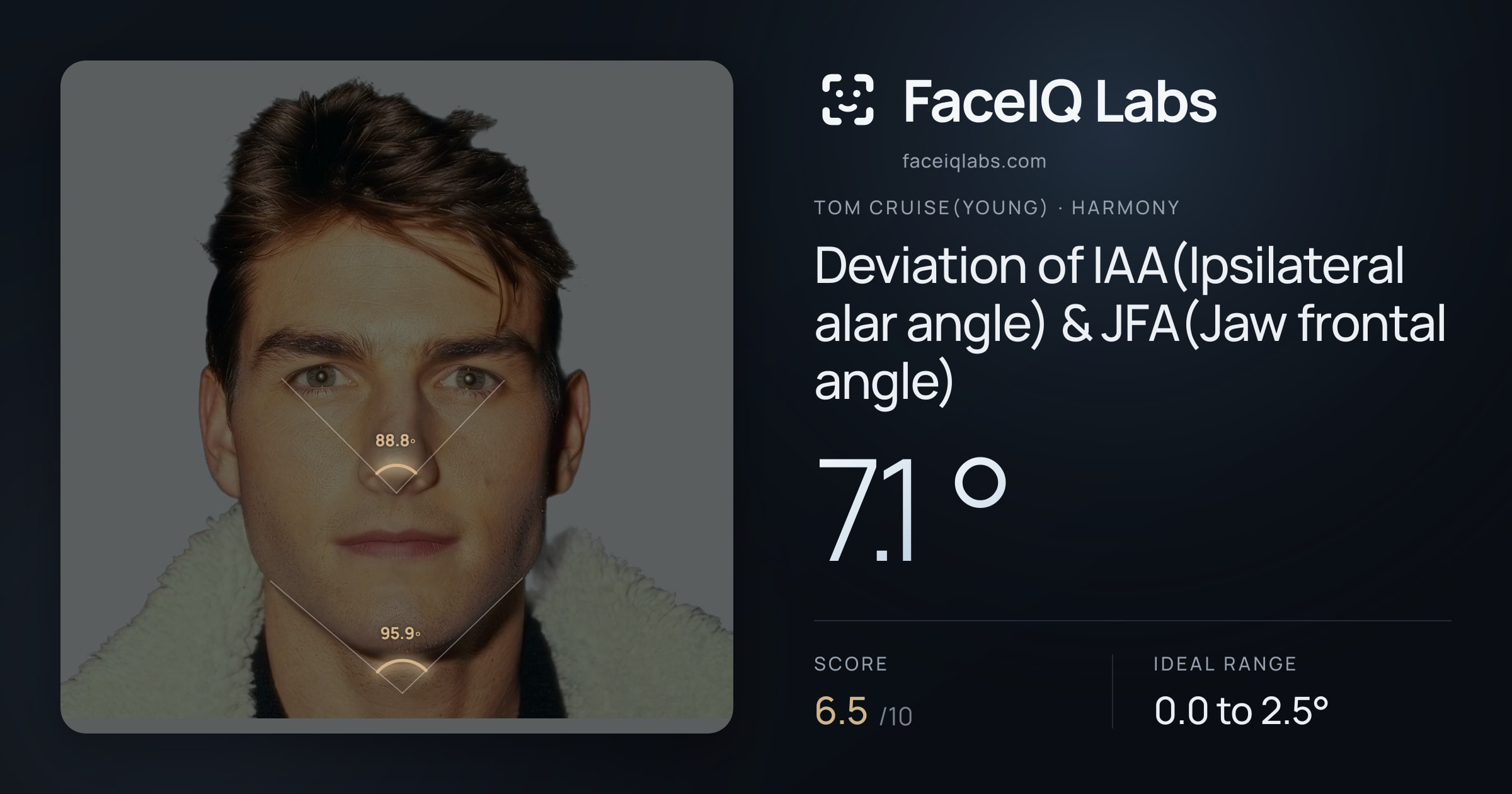 Tom Cruise(Young) Deviation of IAA(Ipsilateral alar angle) & JFA(Jaw frontal angle): 7.1°, drawn on the photo
