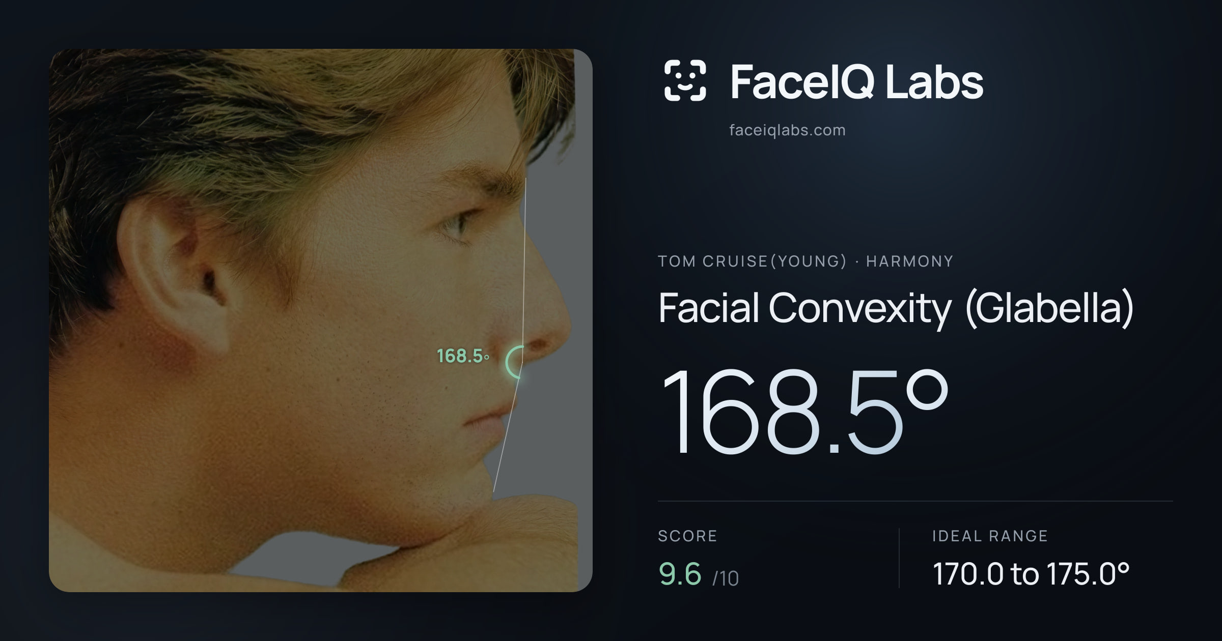 Tom Cruise(Young) Facial Convexity (Glabella): 168.5°, drawn on the photo