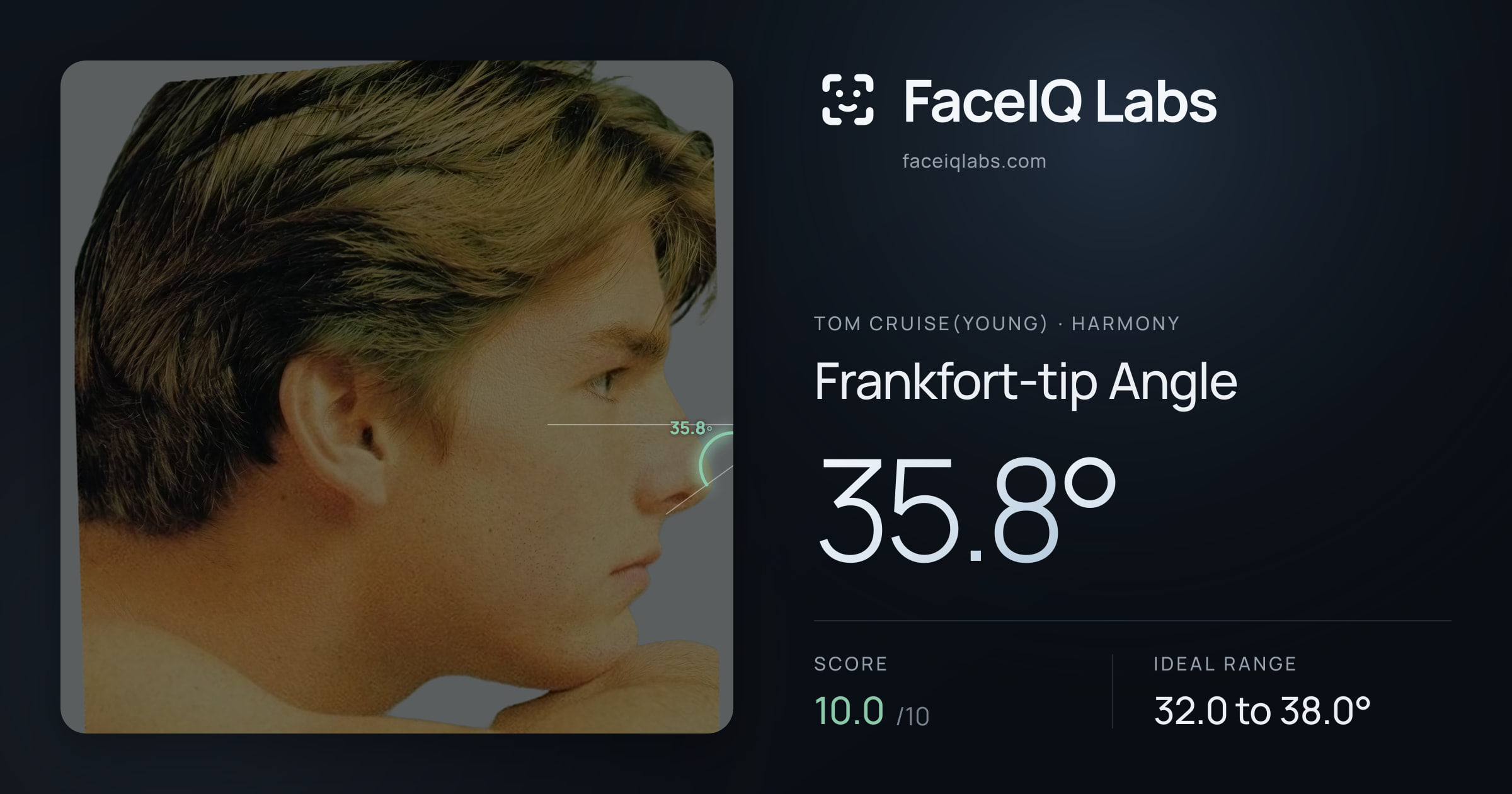 Tom Cruise(Young) Frankfort-tip Angle: 35.8°, drawn on the photo