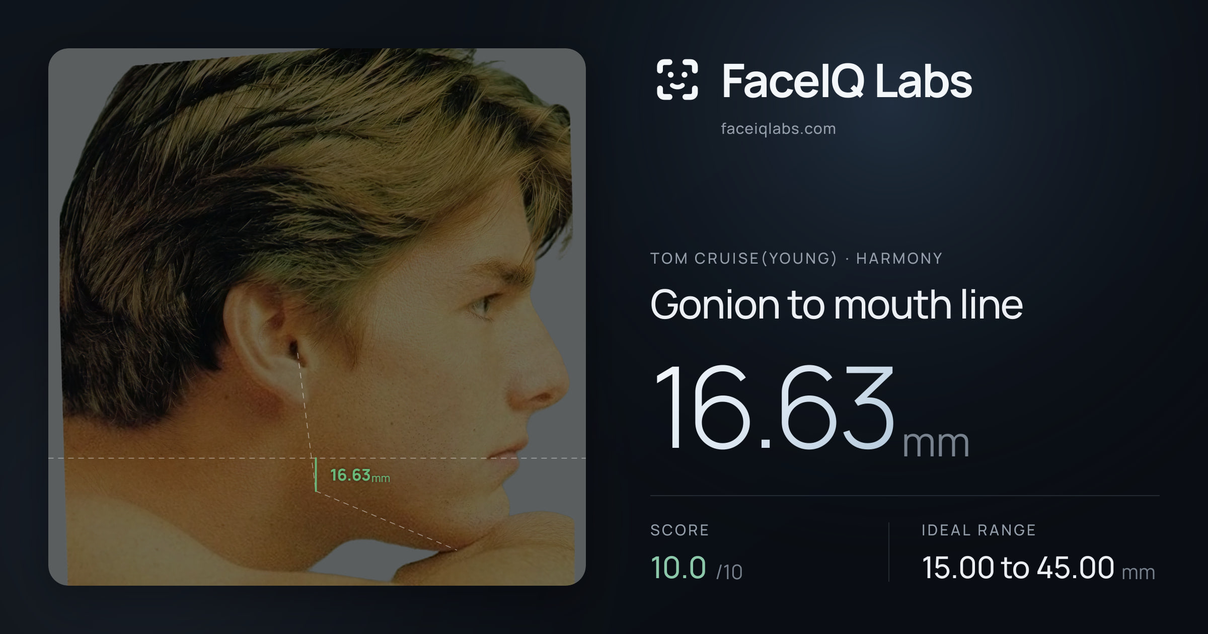 Tom Cruise(Young) Gonion to mouth line: 16.63mm, drawn on the photo