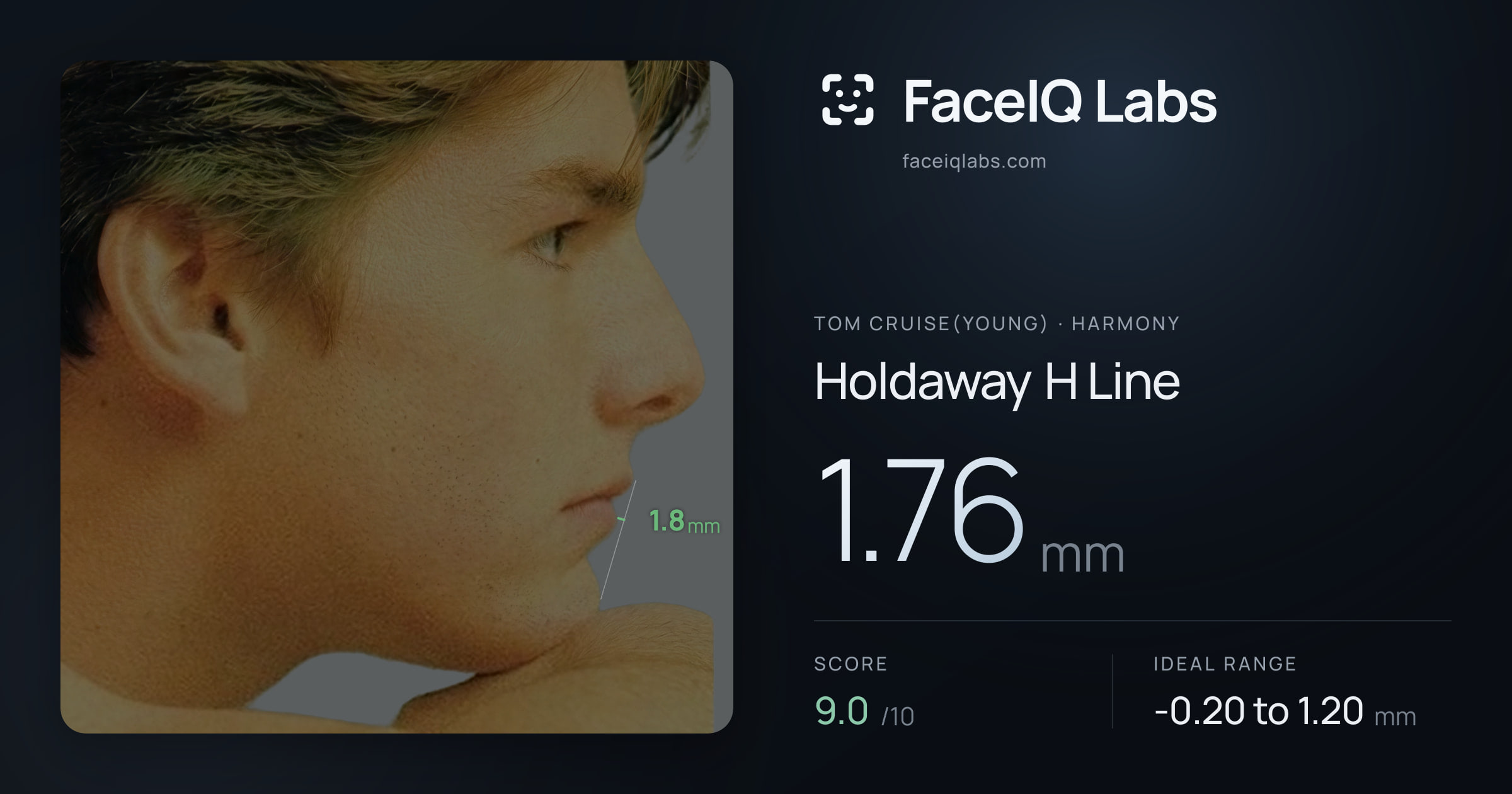 Tom Cruise(Young) Holdaway H Line: 1.76mm, drawn on the photo
