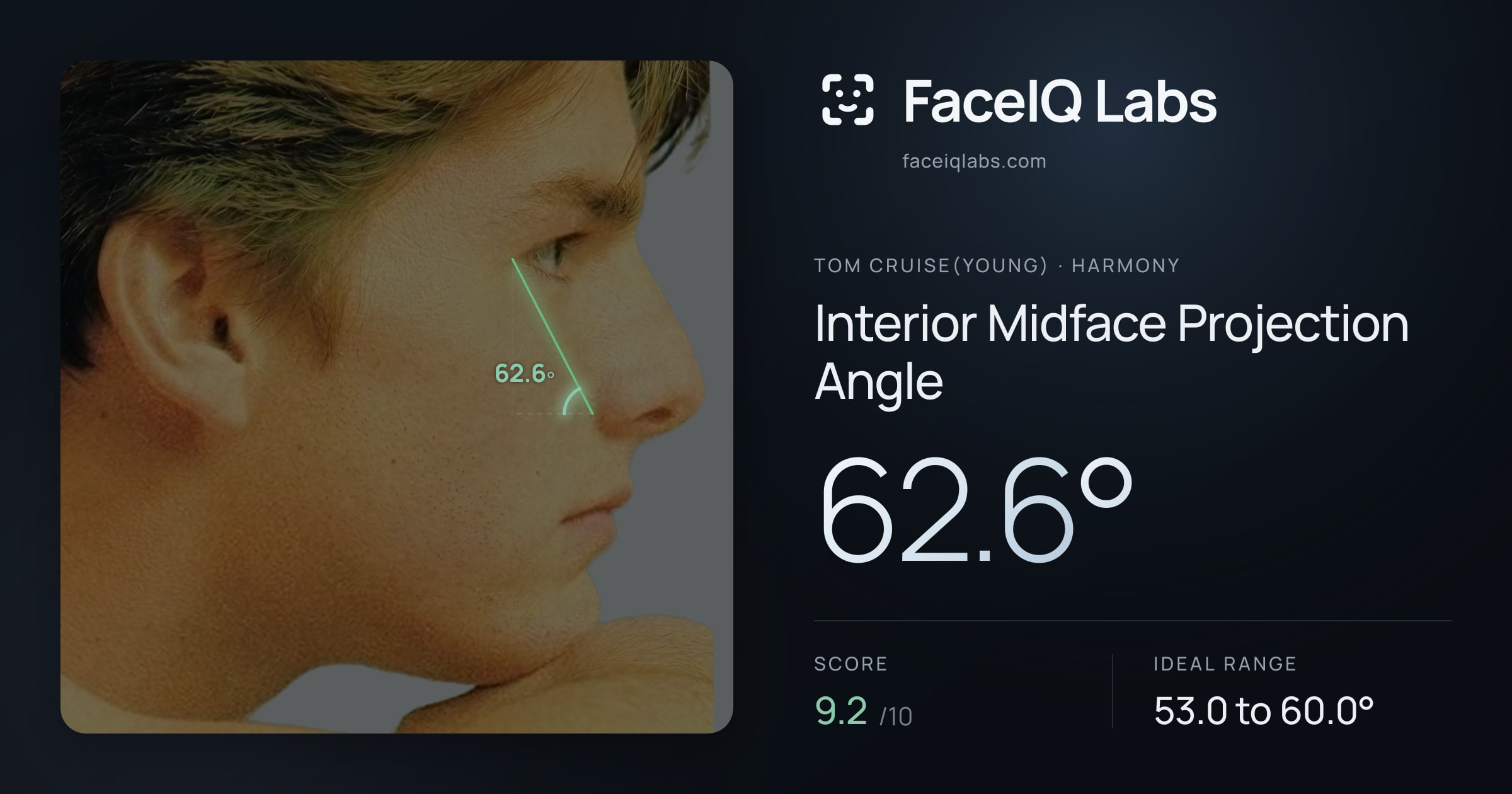Tom Cruise(Young) Interior Midface Projection Angle: 62.6°, drawn on the photo
