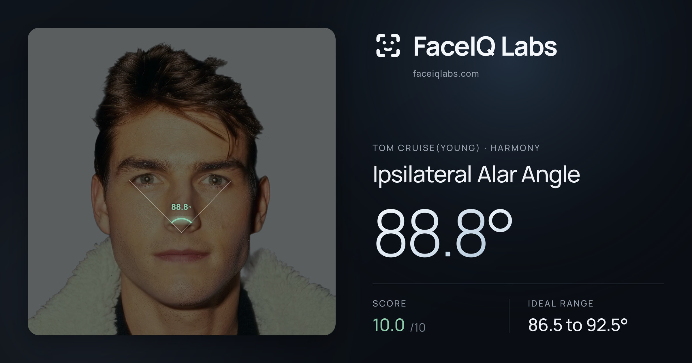 Tom Cruise(Young) Ipsilateral Alar Angle: 88.8°, drawn on the photo