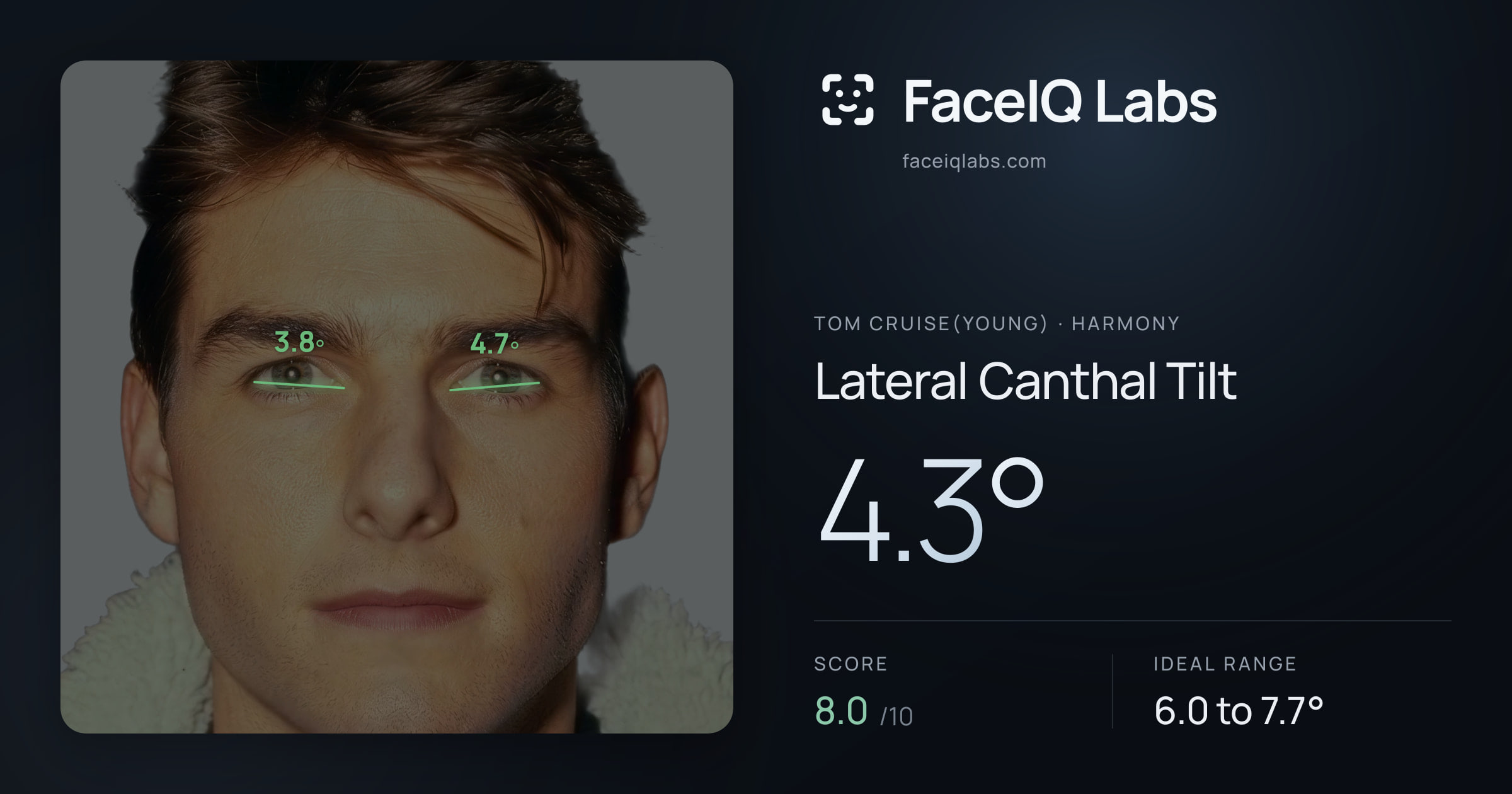 Tom Cruise(Young) Lateral Canthal Tilt: 4.3°, drawn on the photo