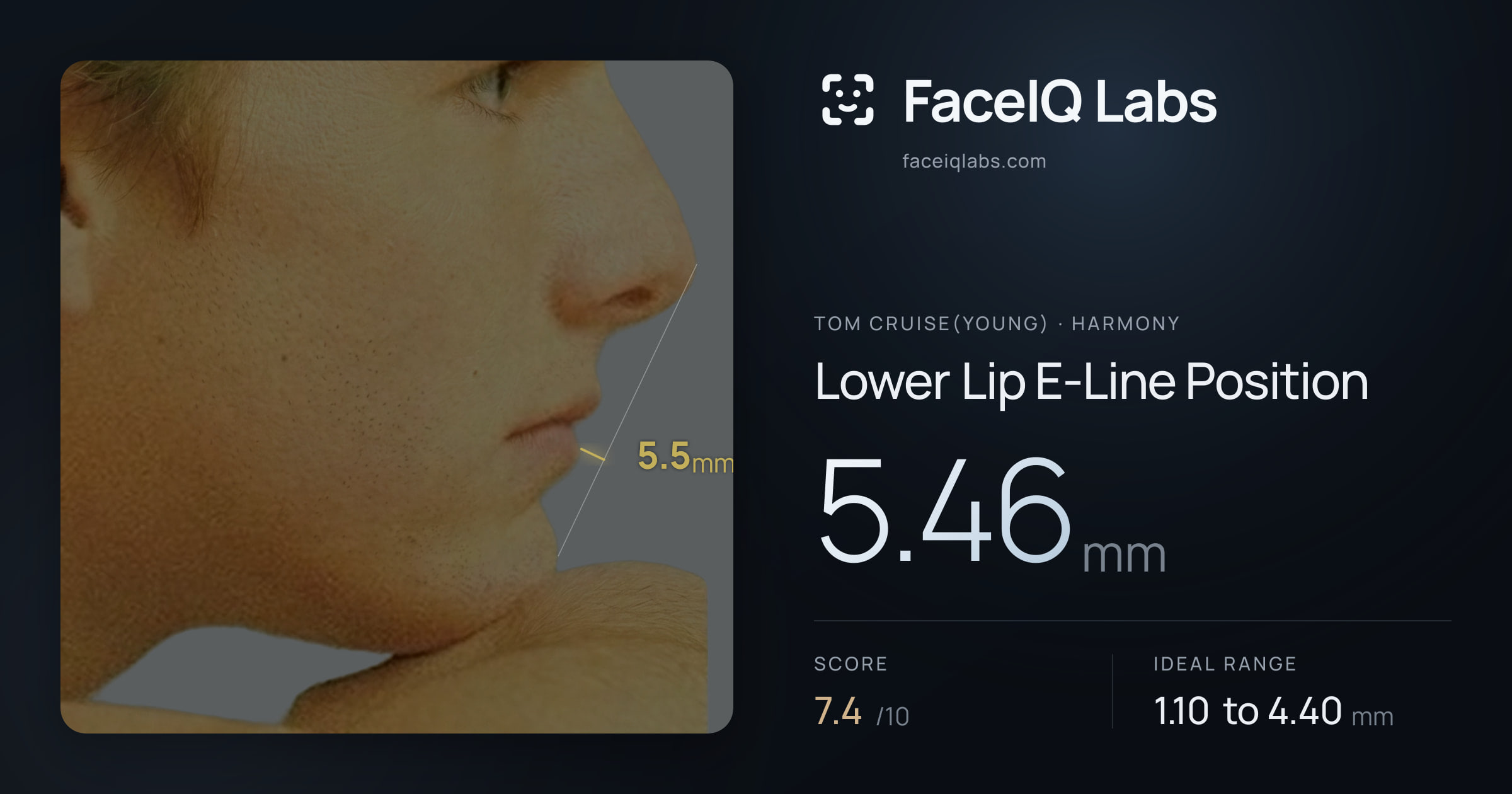 Tom Cruise(Young) Lower Lip E-Line Position: 5.46mm, drawn on the photo