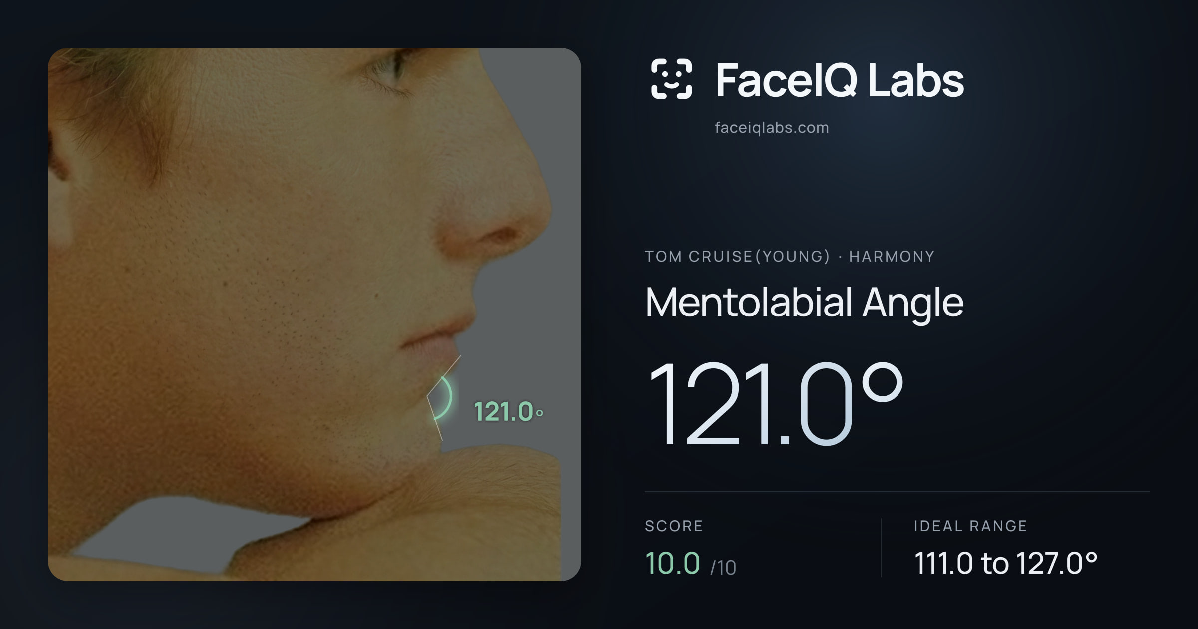 Tom Cruise(Young) Mentolabial Angle: 121.0°, drawn on the photo