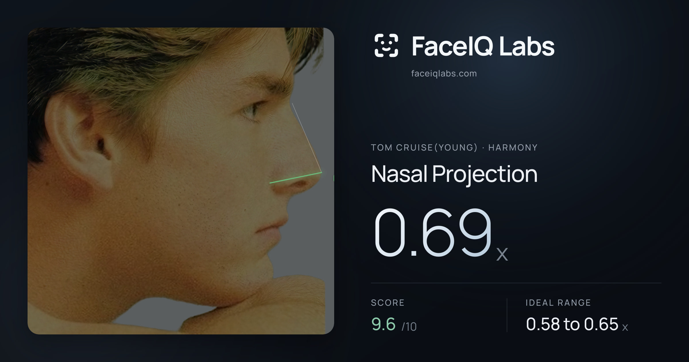 Tom Cruise(Young) Nasal Projection: 0.69x, drawn on the photo