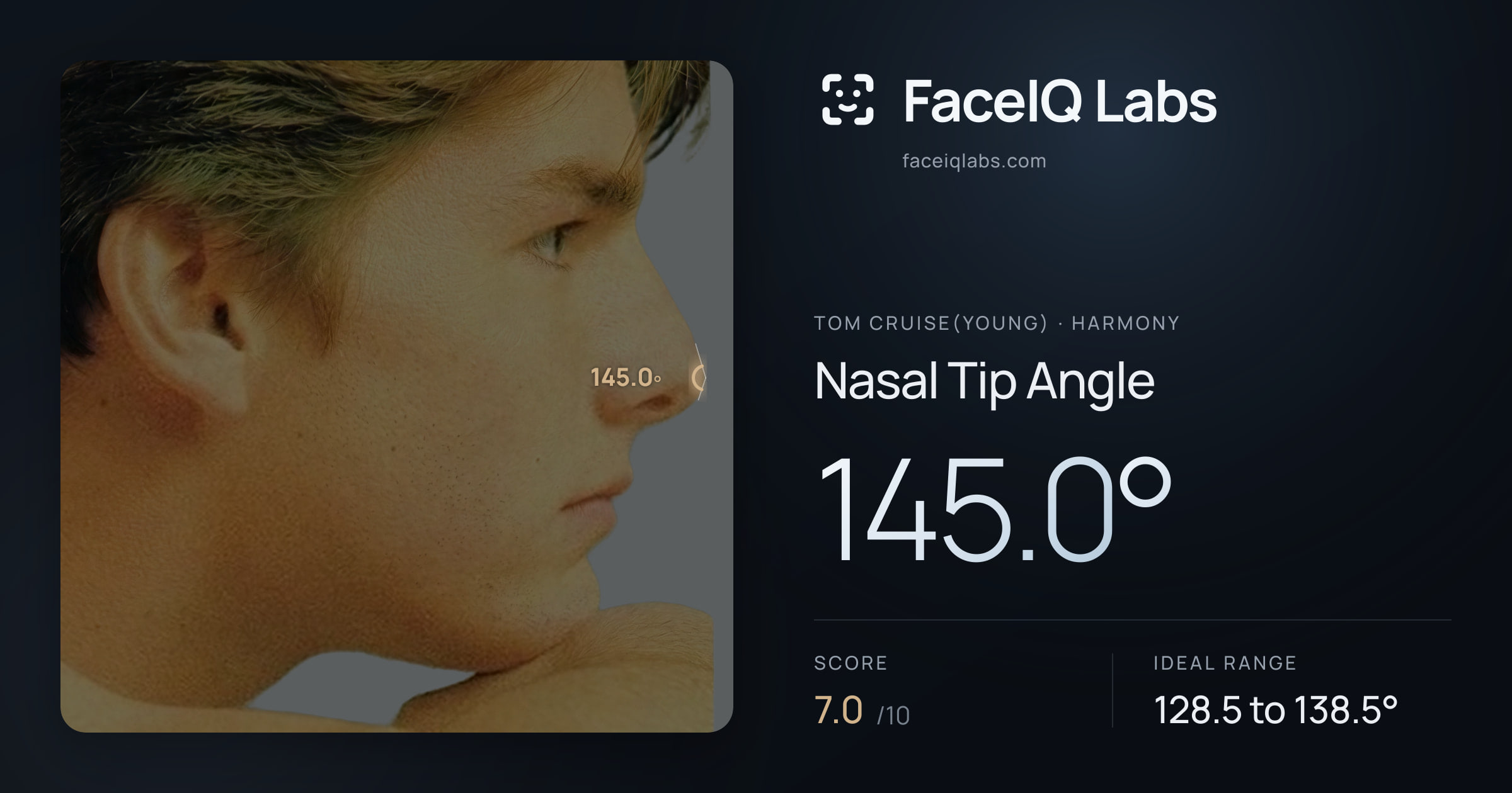 Tom Cruise(Young) Nasal Tip Angle: 145.0°, drawn on the photo