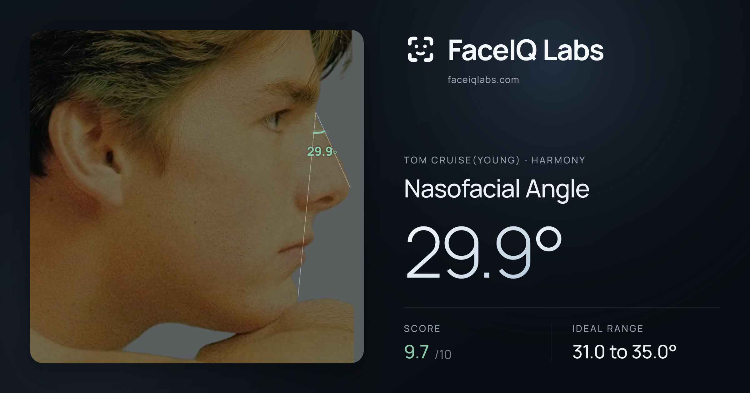 Tom Cruise(Young) Nasofacial Angle: 29.9°, drawn on the photo