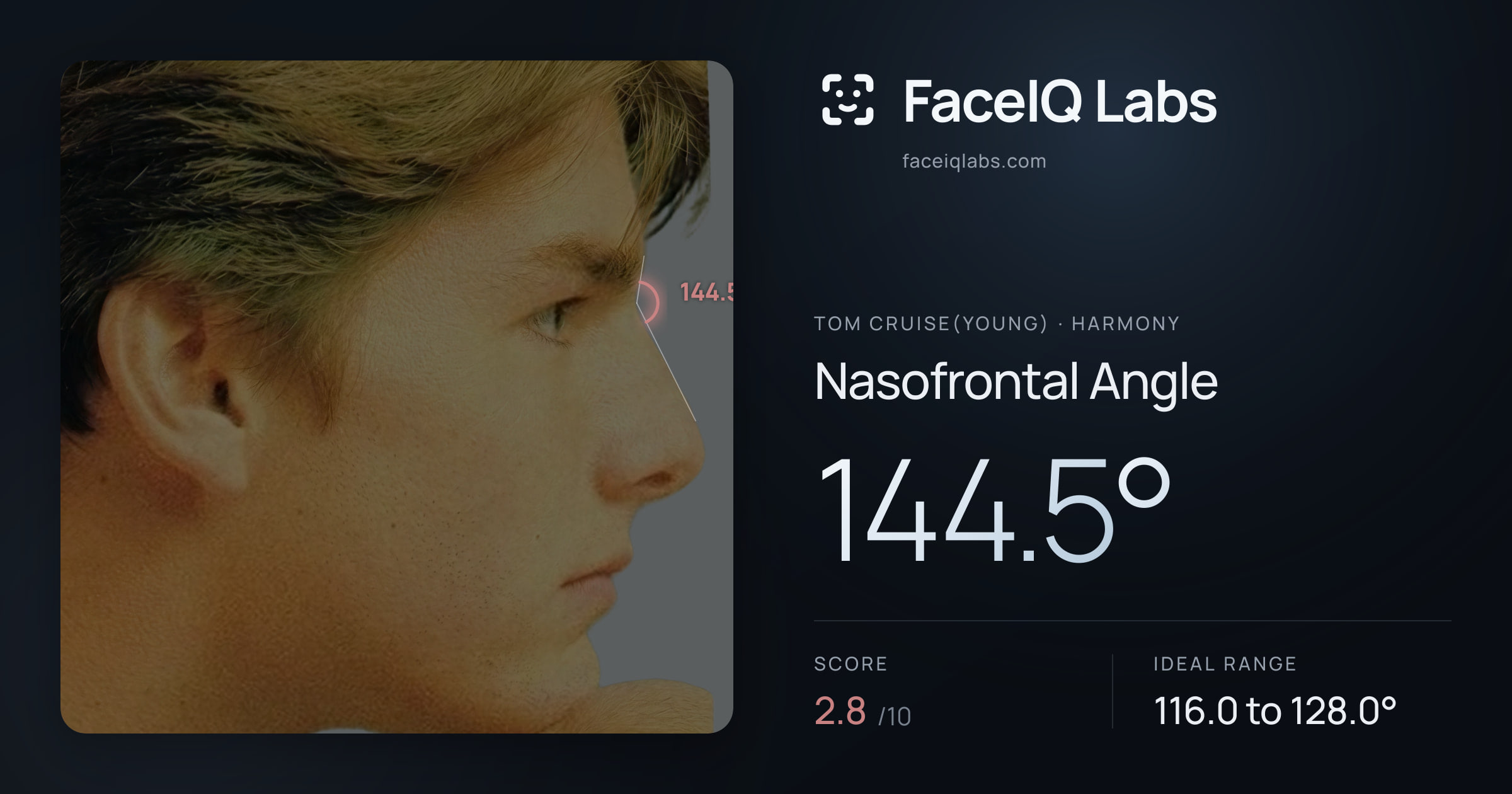 Tom Cruise(Young) Nasofrontal Angle: 144.5°, drawn on the photo