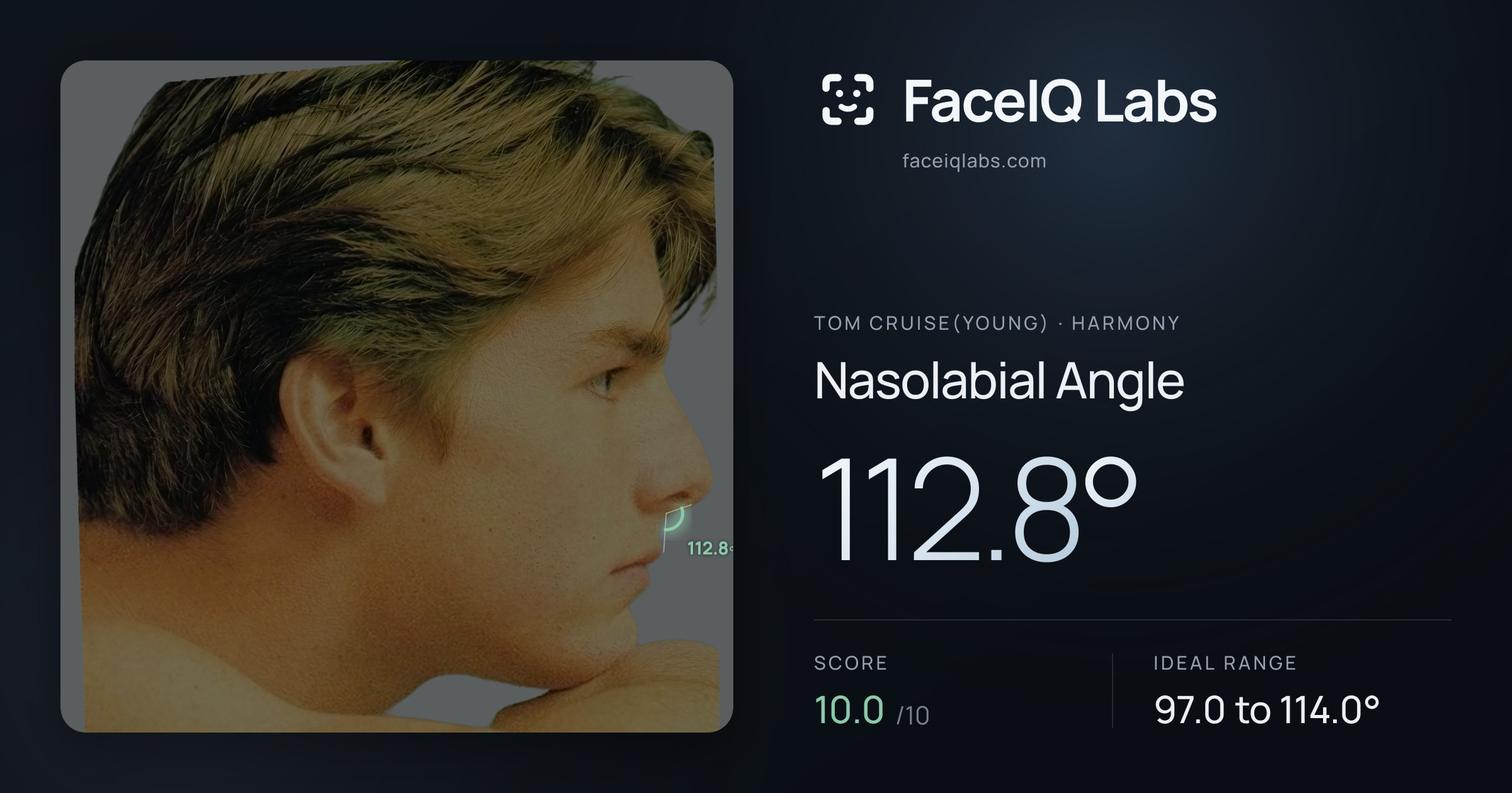 Tom Cruise(Young) Nasolabial Angle: 112.8°, drawn on the photo