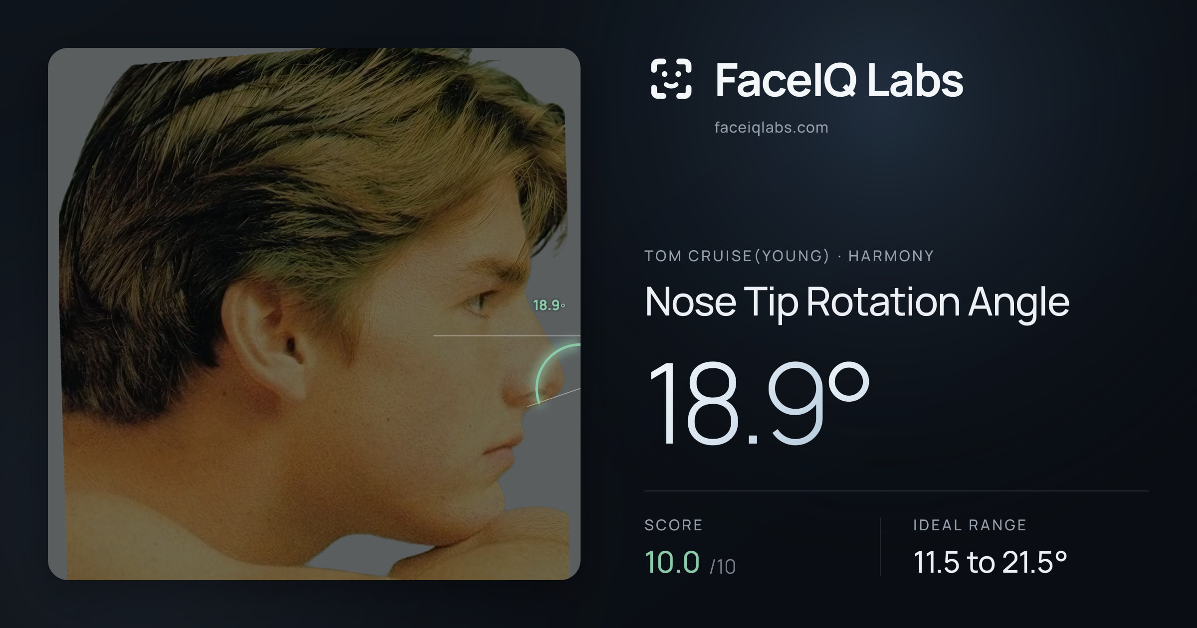Tom Cruise(Young) Nose Tip Rotation Angle: 18.9°, drawn on the photo