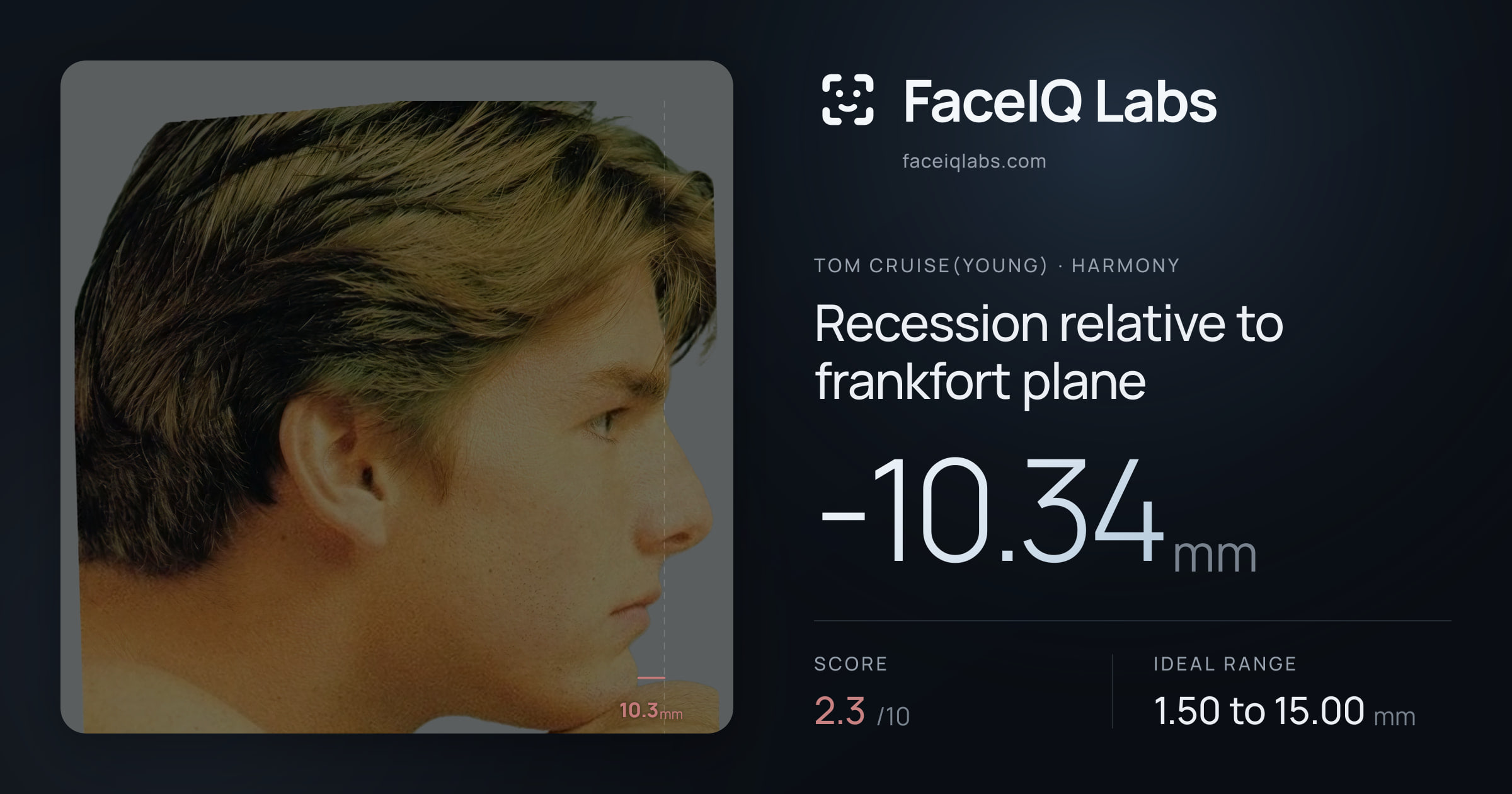 Tom Cruise(Young) Recession relative to frankfort plane: -10.34mm, drawn on the photo