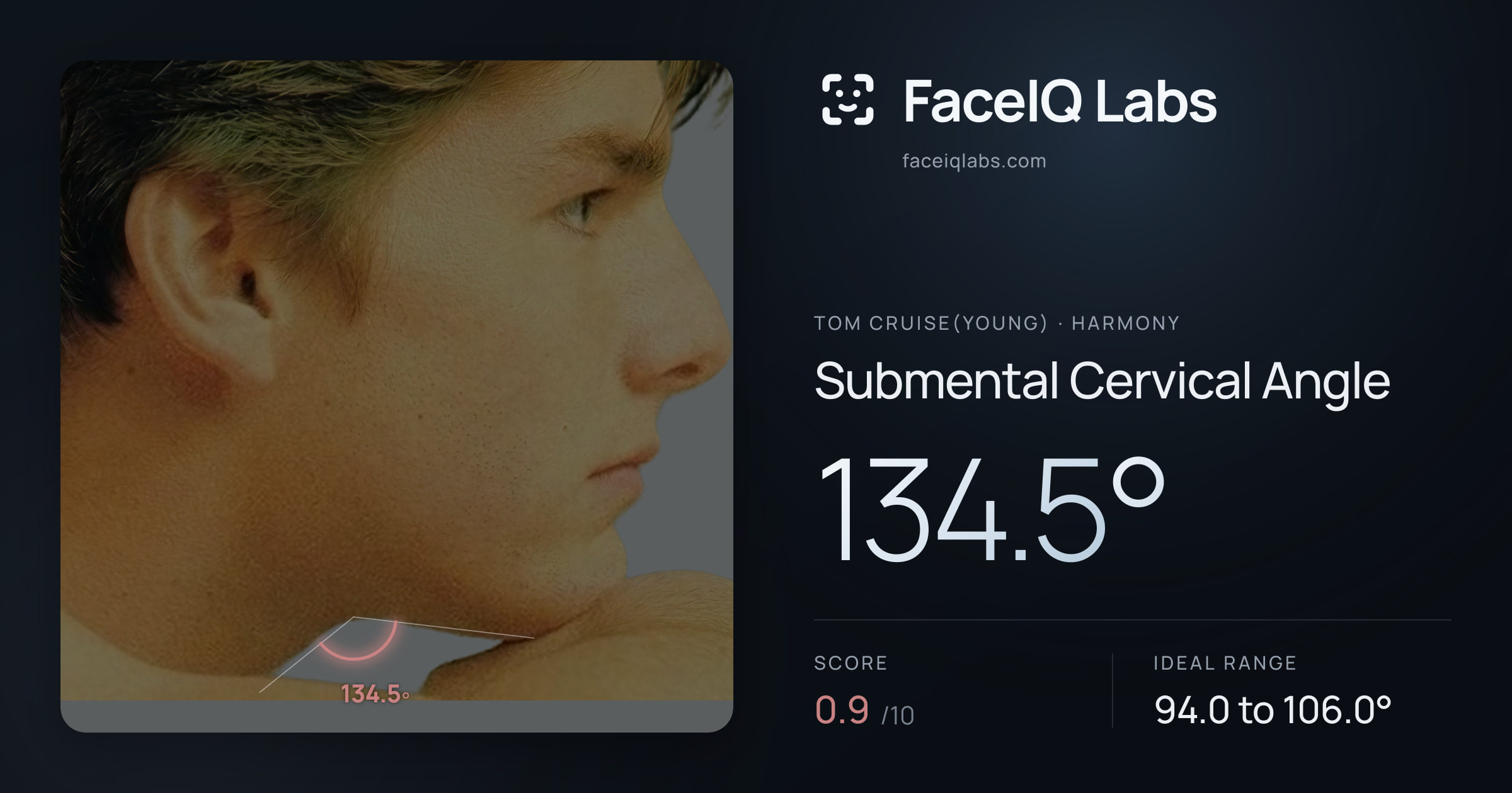 Tom Cruise(Young) Submental Cervical Angle: 134.5°, drawn on the photo