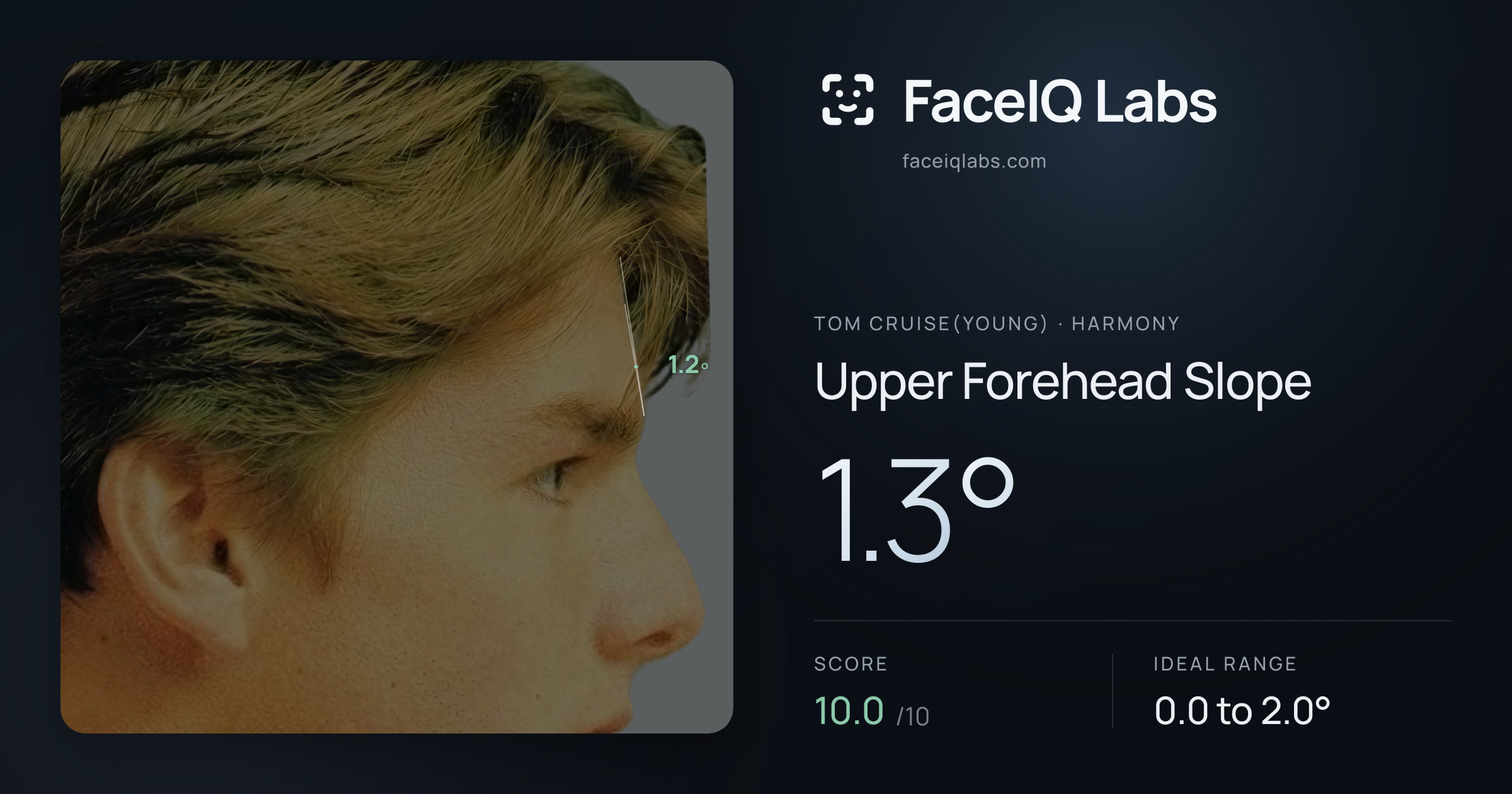 Tom Cruise(Young) Upper Forehead Slope: 1.3°, drawn on the photo