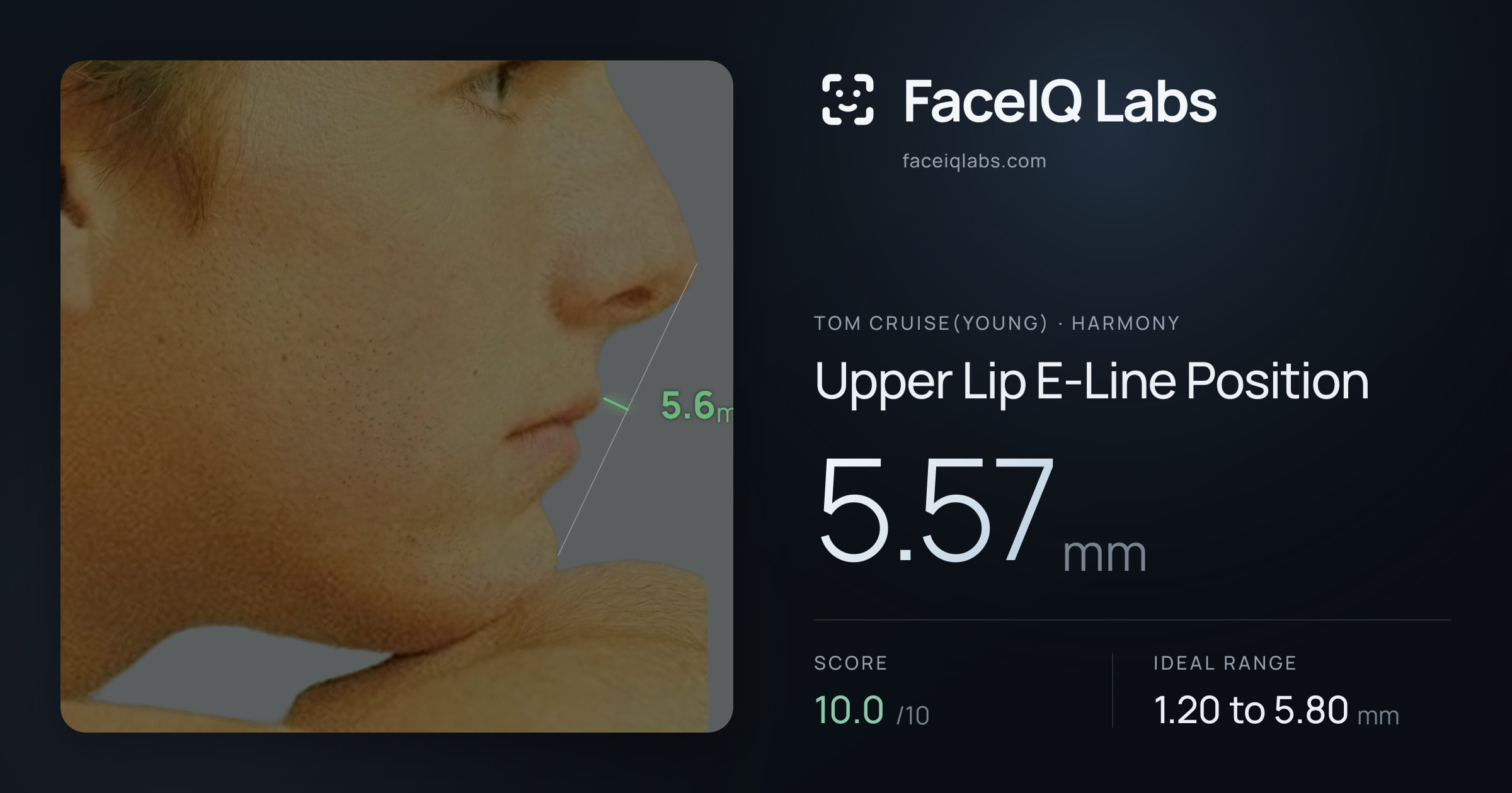 Tom Cruise(Young) Upper Lip E-Line Position: 5.57mm, drawn on the photo