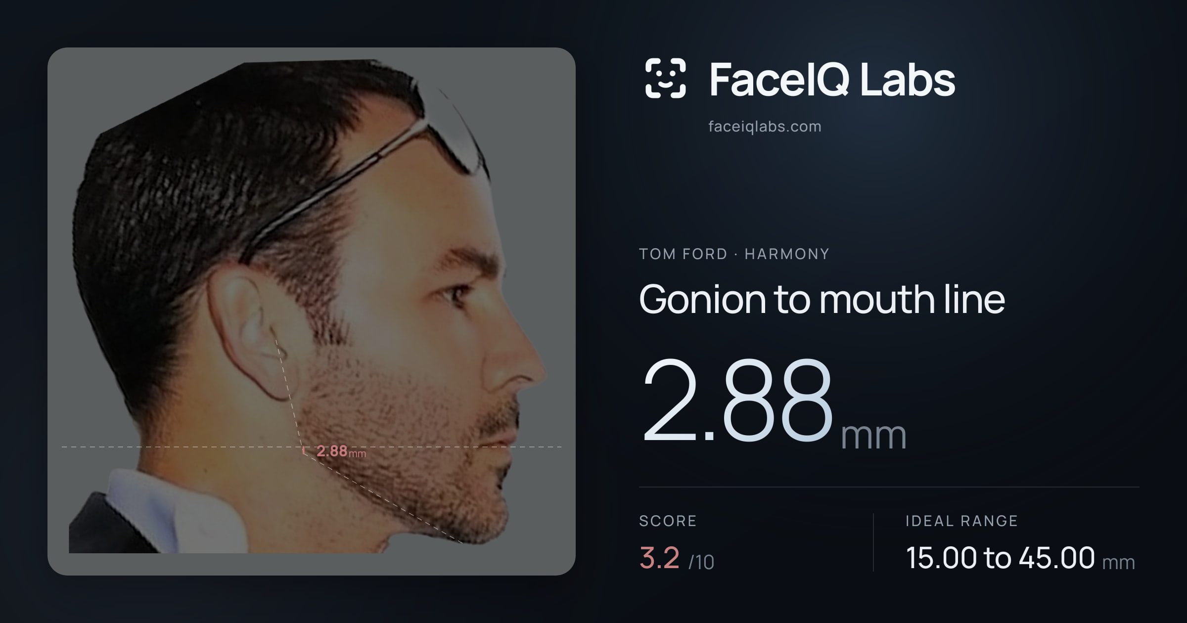 Tom Ford Gonion to mouth line: 2.88mm, drawn on the photo
