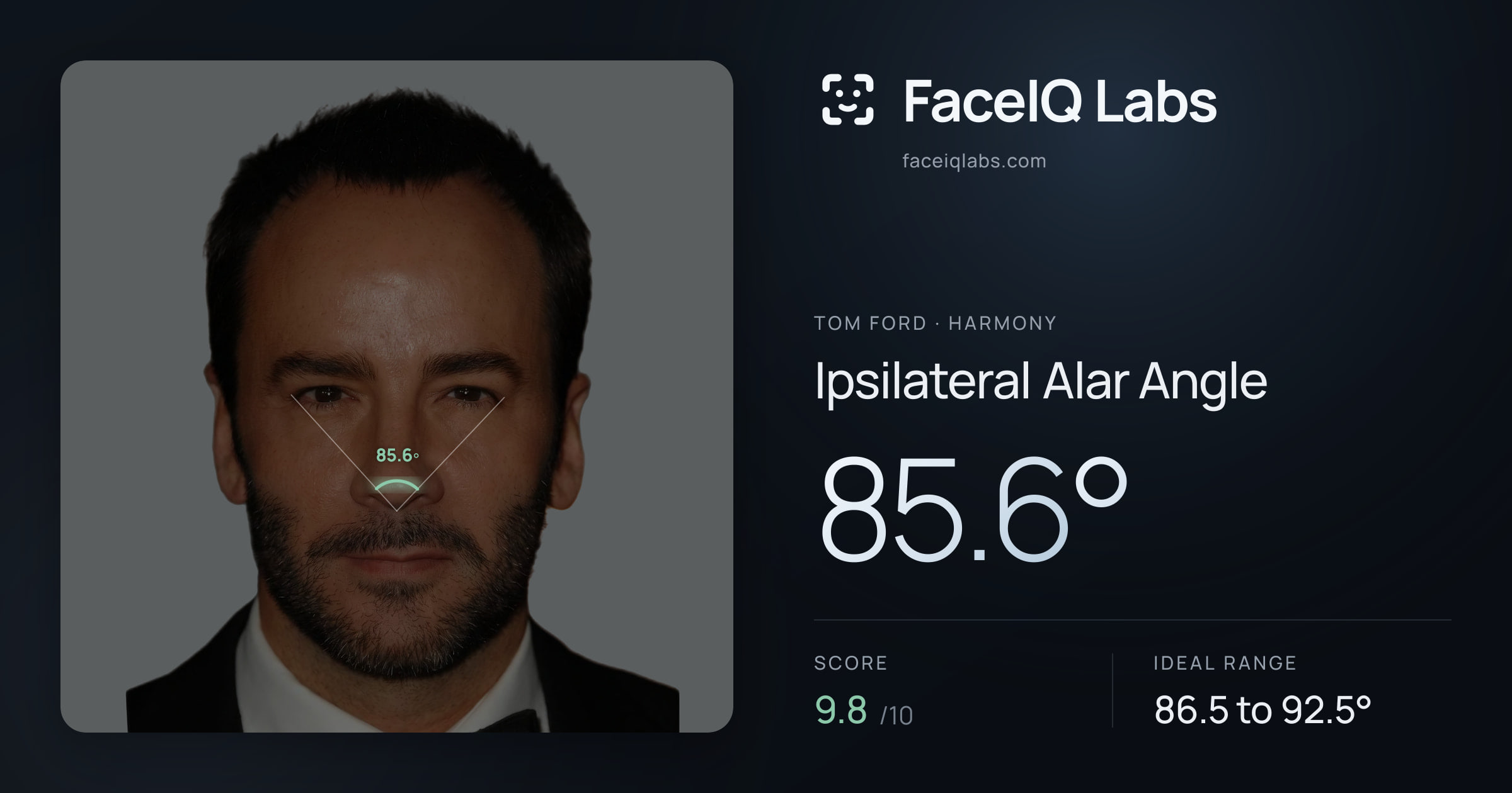Tom Ford Ipsilateral Alar Angle: 85.6°, drawn on the photo