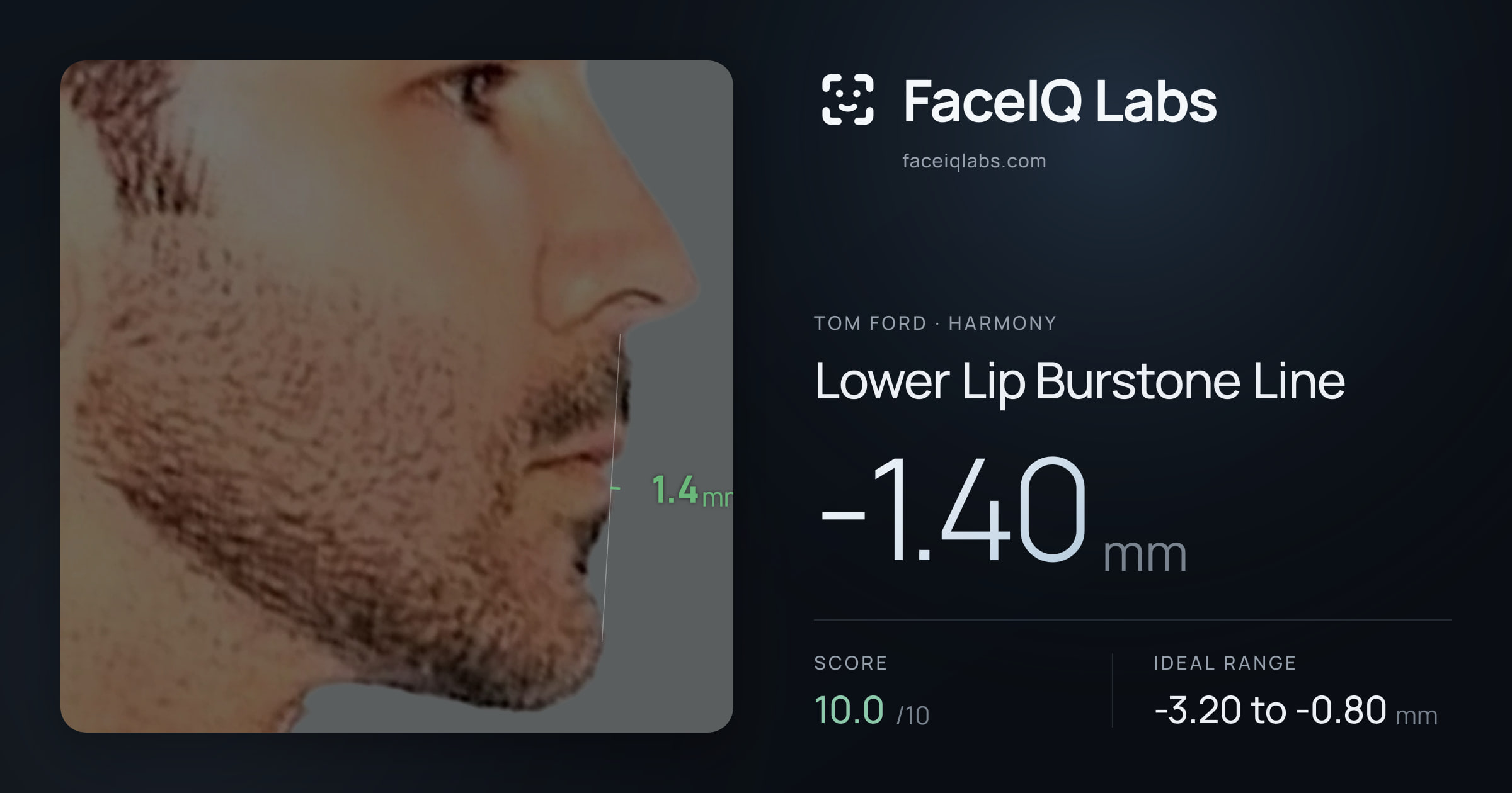 Tom Ford Lower Lip Burstone Line: -1.40mm, drawn on the photo