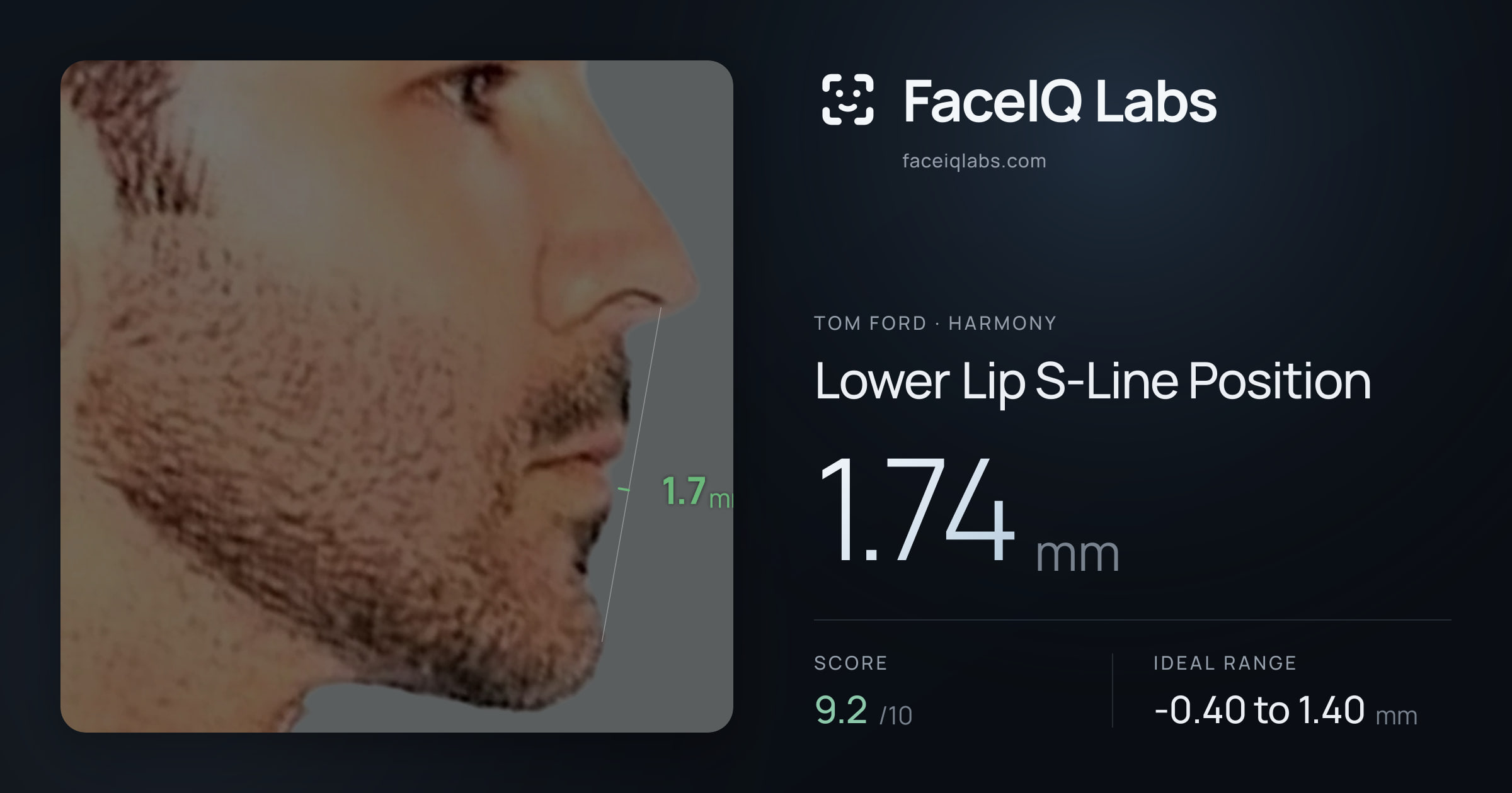Tom Ford Lower Lip S-Line Position: 1.74mm, drawn on the photo
