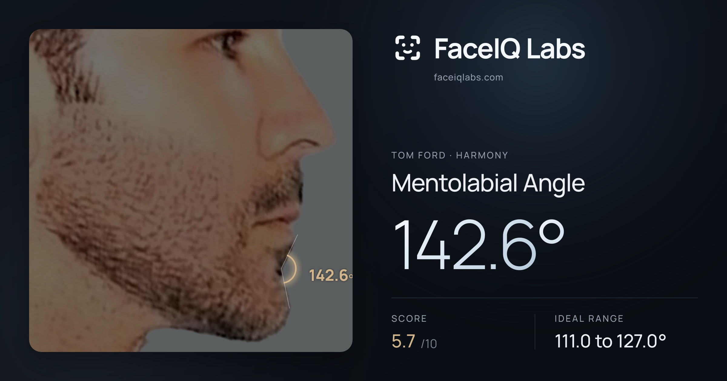 Tom Ford Mentolabial Angle: 142.6°, drawn on the photo