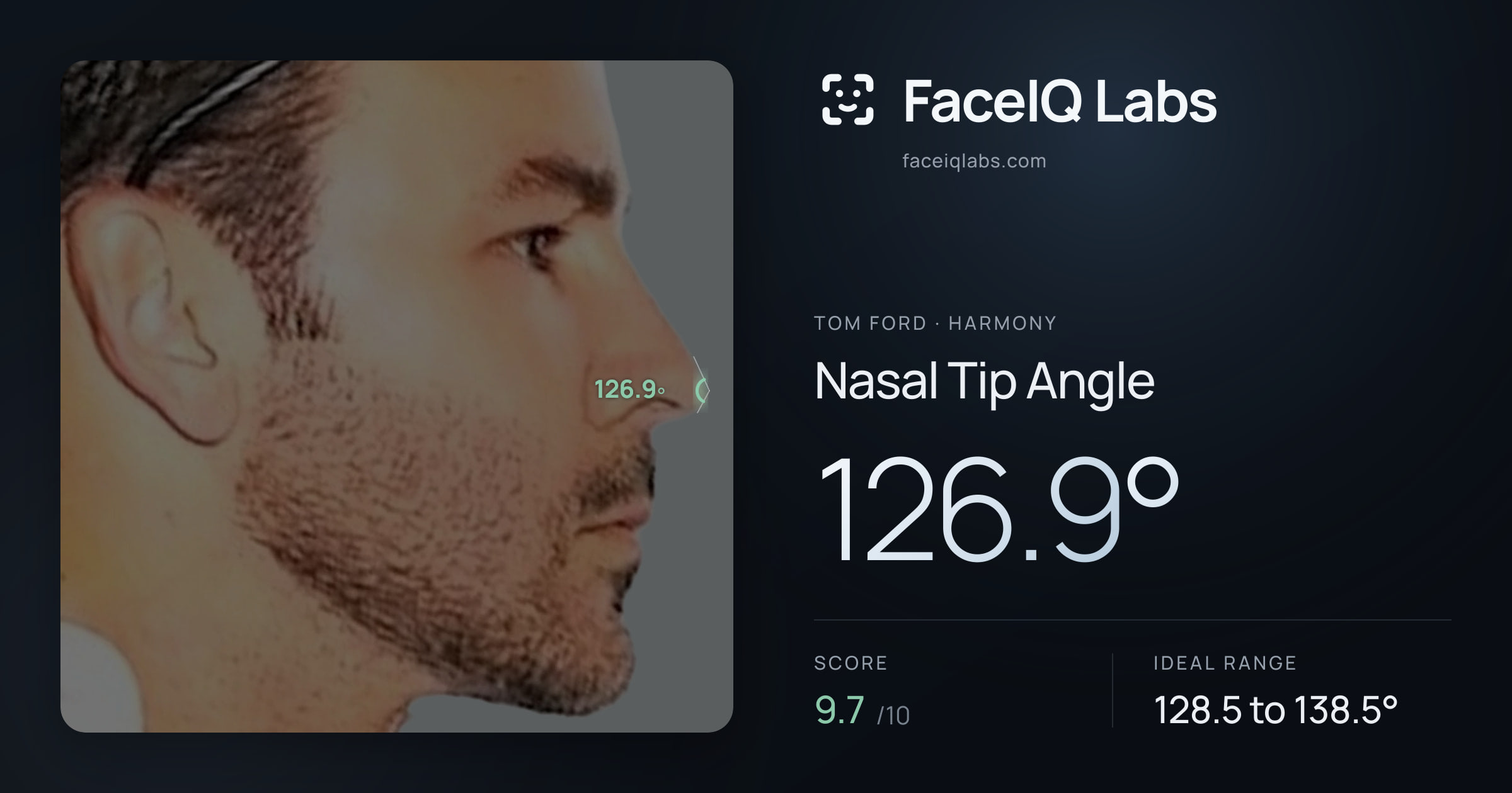 Tom Ford Nasal Tip Angle: 126.9°, drawn on the photo