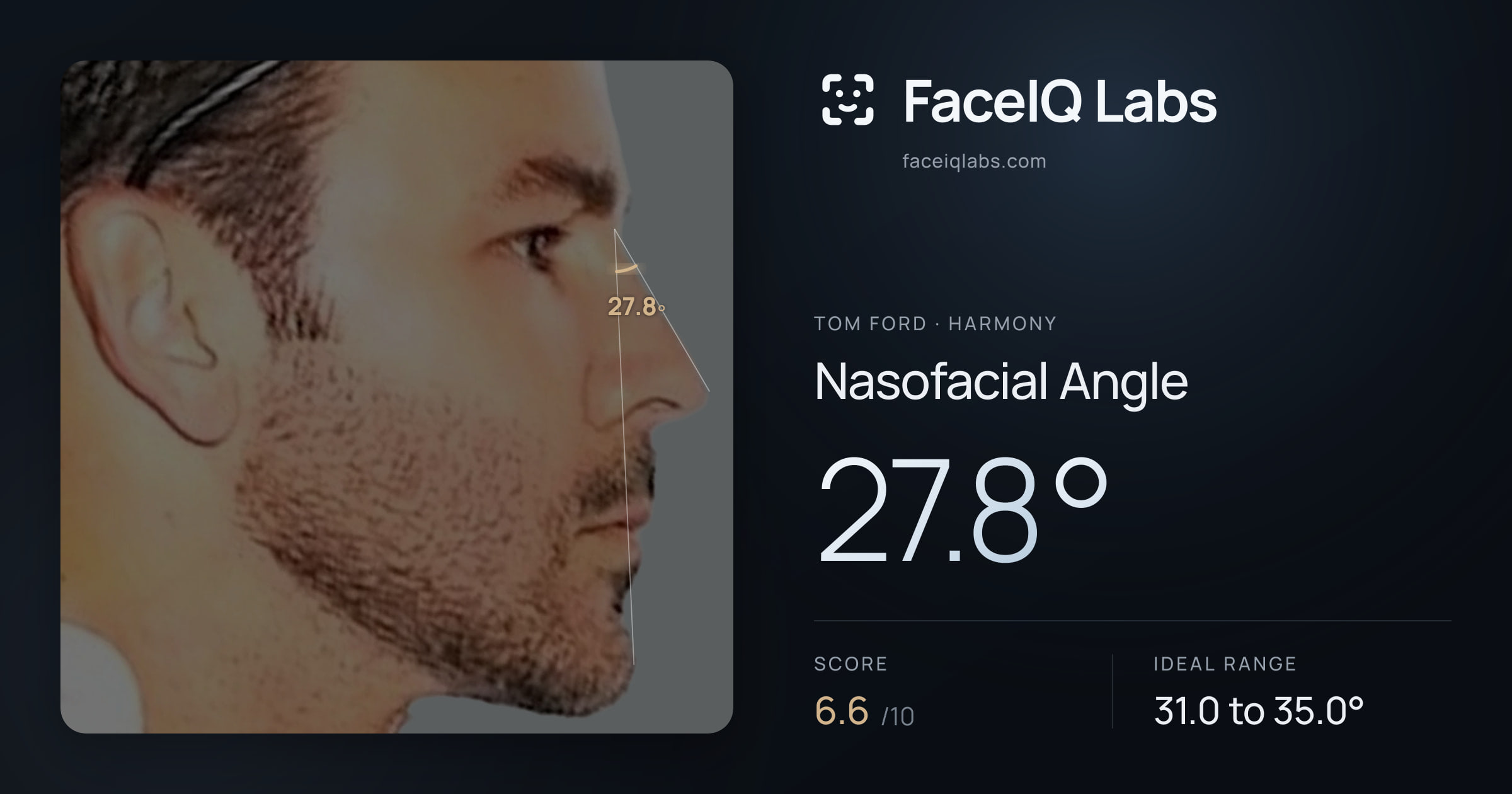 Tom Ford Nasofacial Angle: 27.8°, drawn on the photo