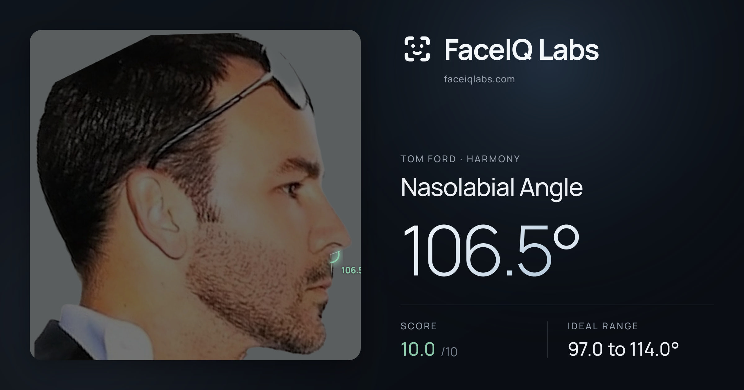 Tom Ford Nasolabial Angle: 106.5°, drawn on the photo