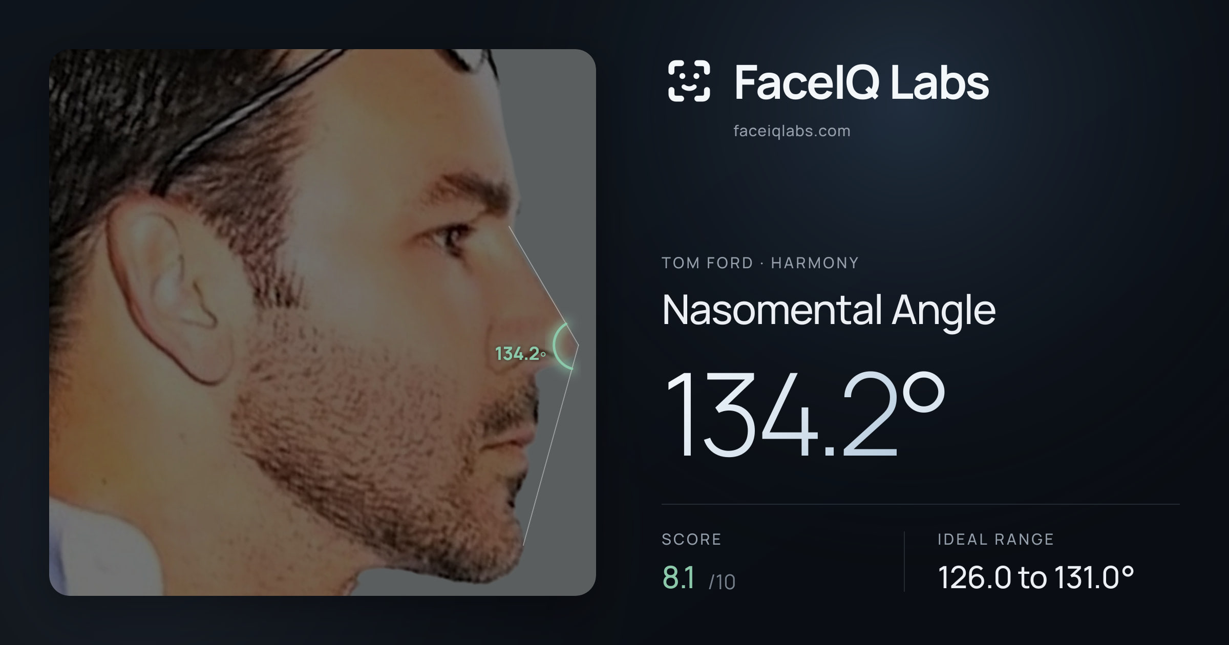 Tom Ford Nasomental Angle: 134.2°, drawn on the photo