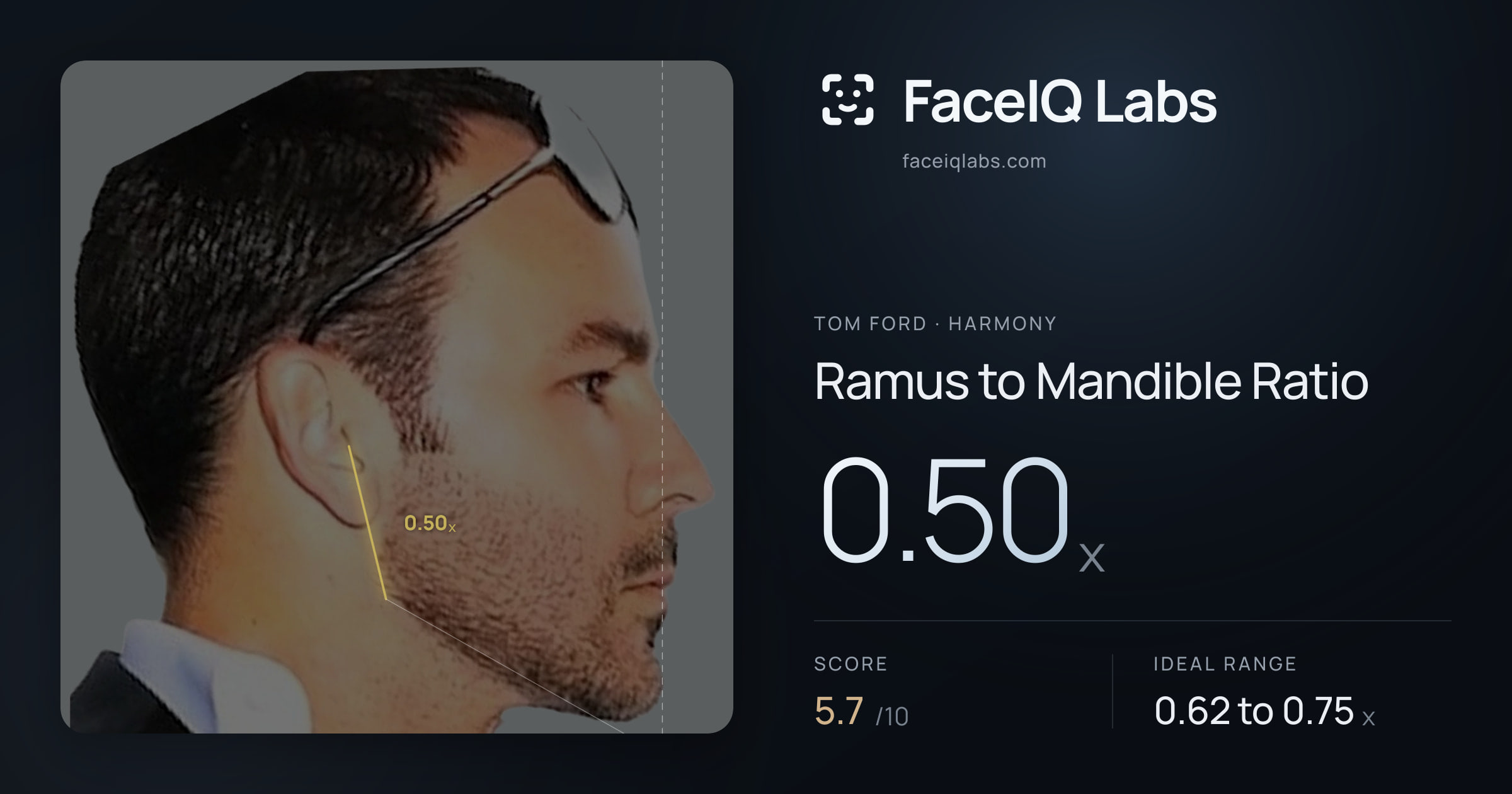 Tom Ford Ramus to Mandible Ratio: 0.50x, drawn on the photo