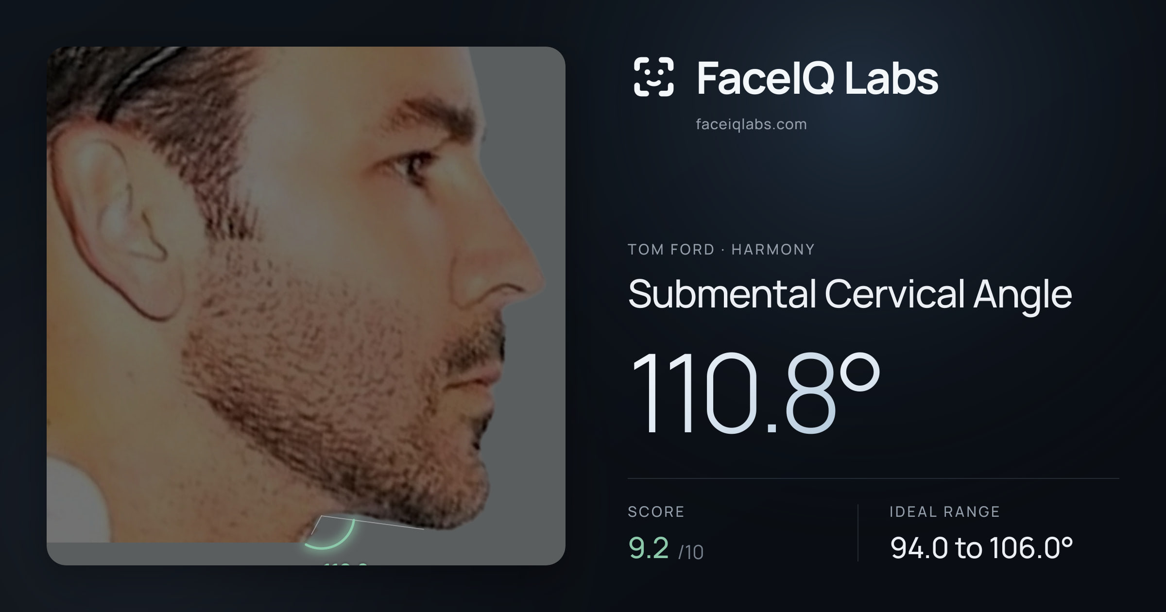 Tom Ford Submental Cervical Angle: 110.8°, drawn on the photo