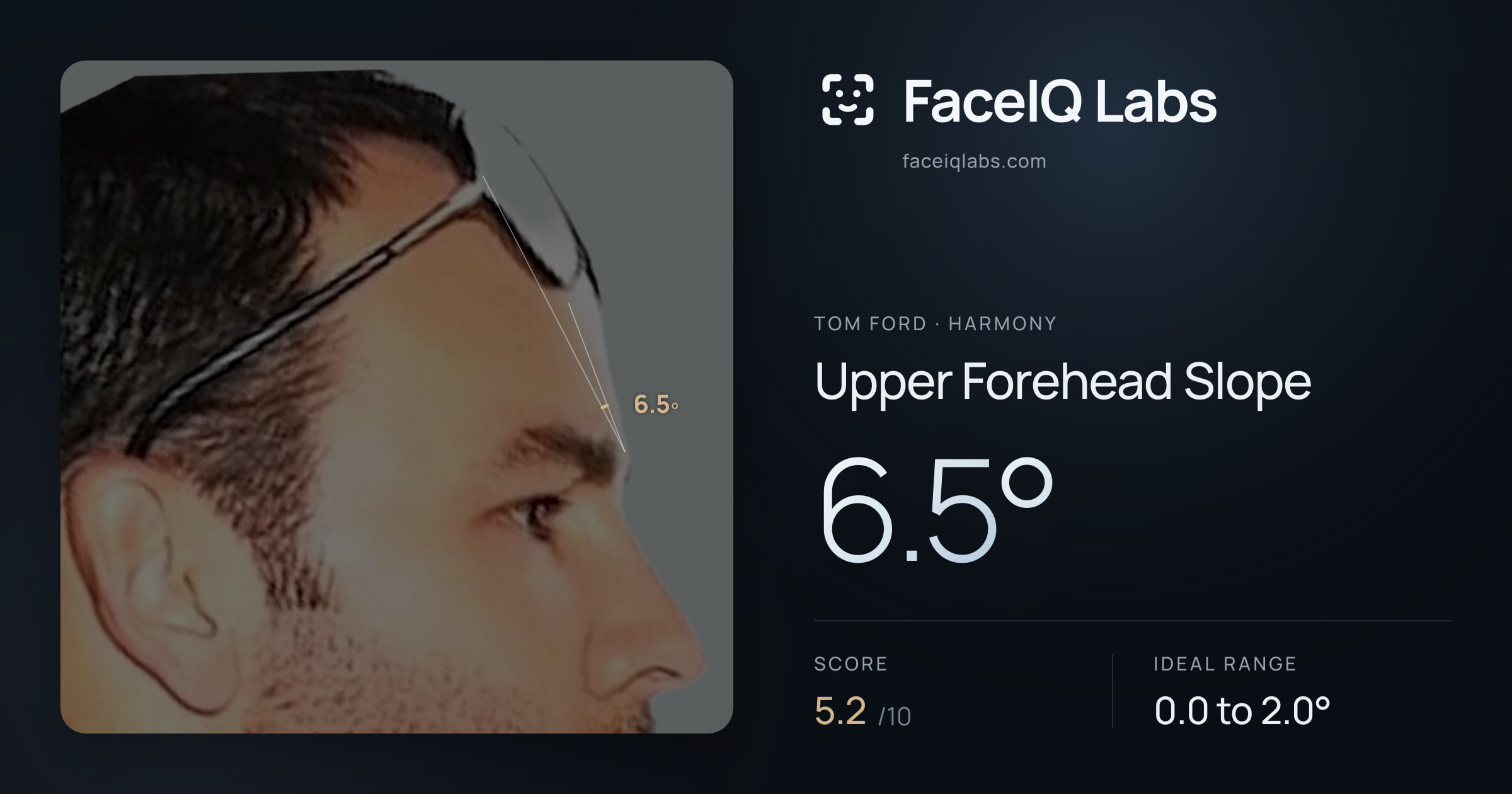 Tom Ford Upper Forehead Slope: 6.5°, drawn on the photo
