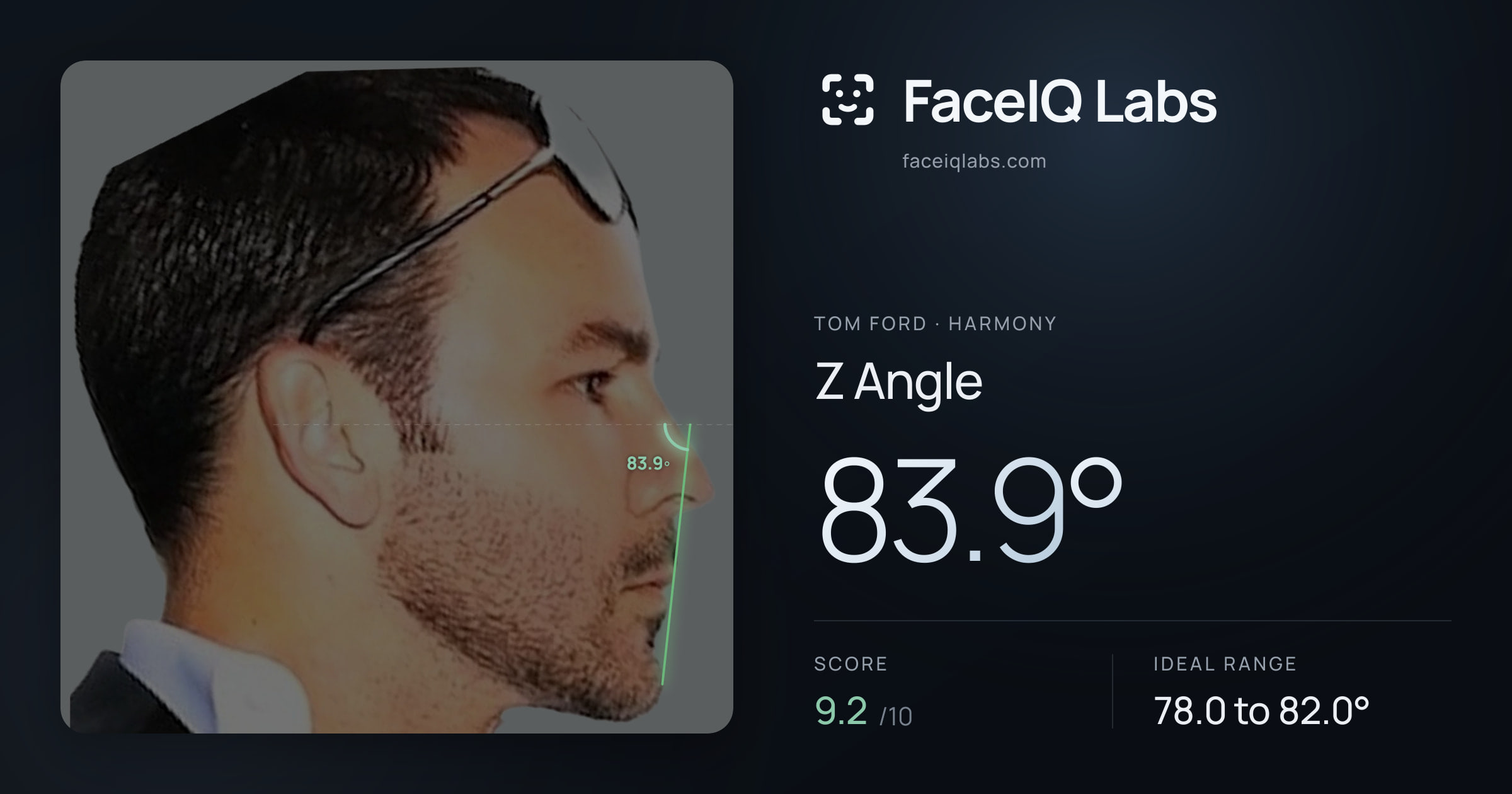 Tom Ford Z Angle: 83.9°, drawn on the photo