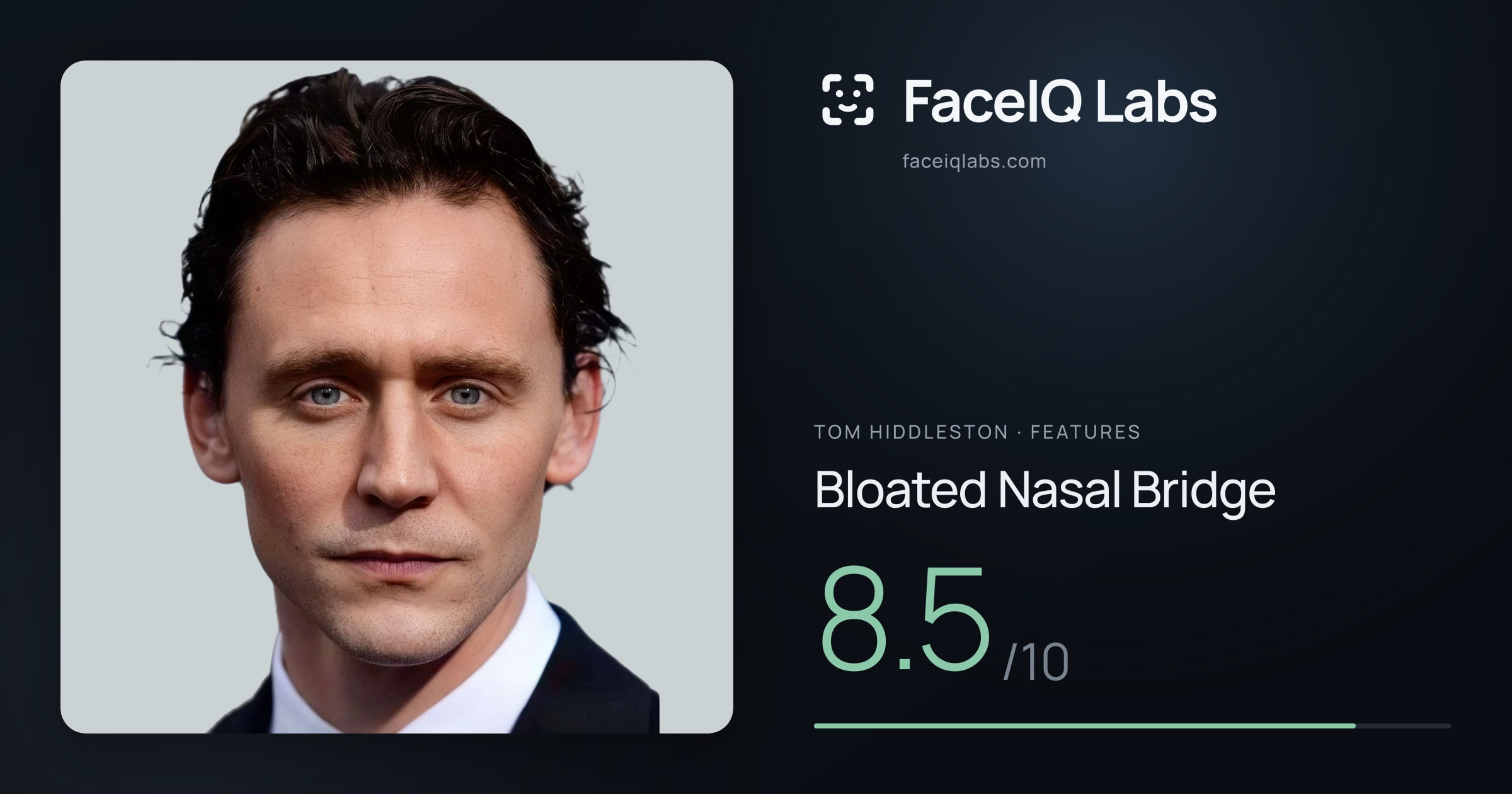 Tom Hiddleston Bloated Nasal Bridge: 8.5/10, drawn on the photo