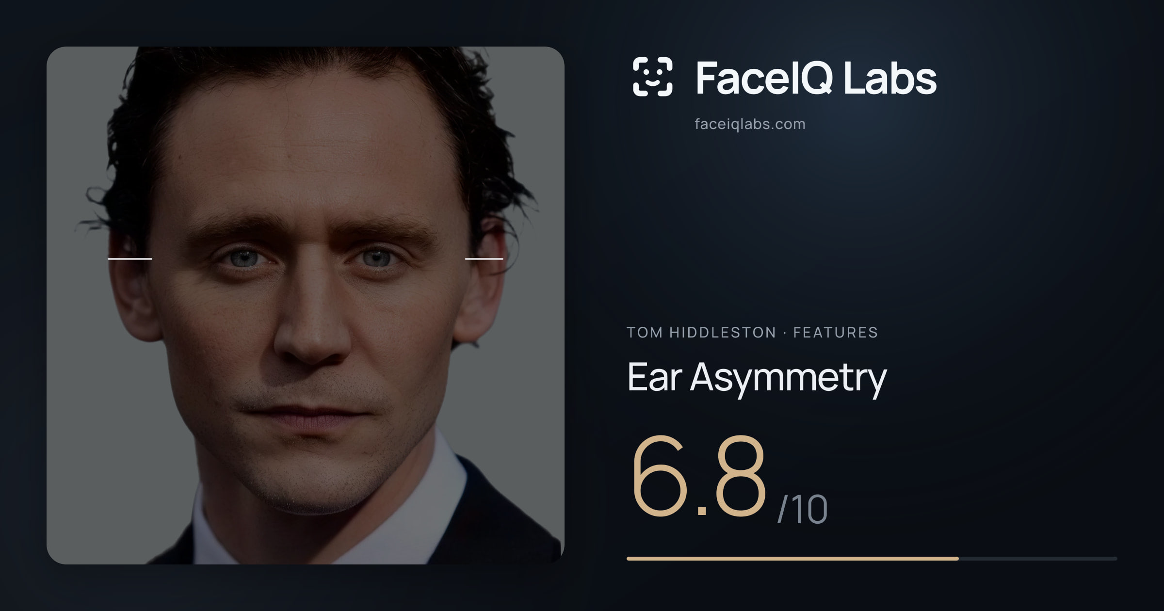 Tom Hiddleston Ear Asymmetry: 6.8/10, drawn on the photo