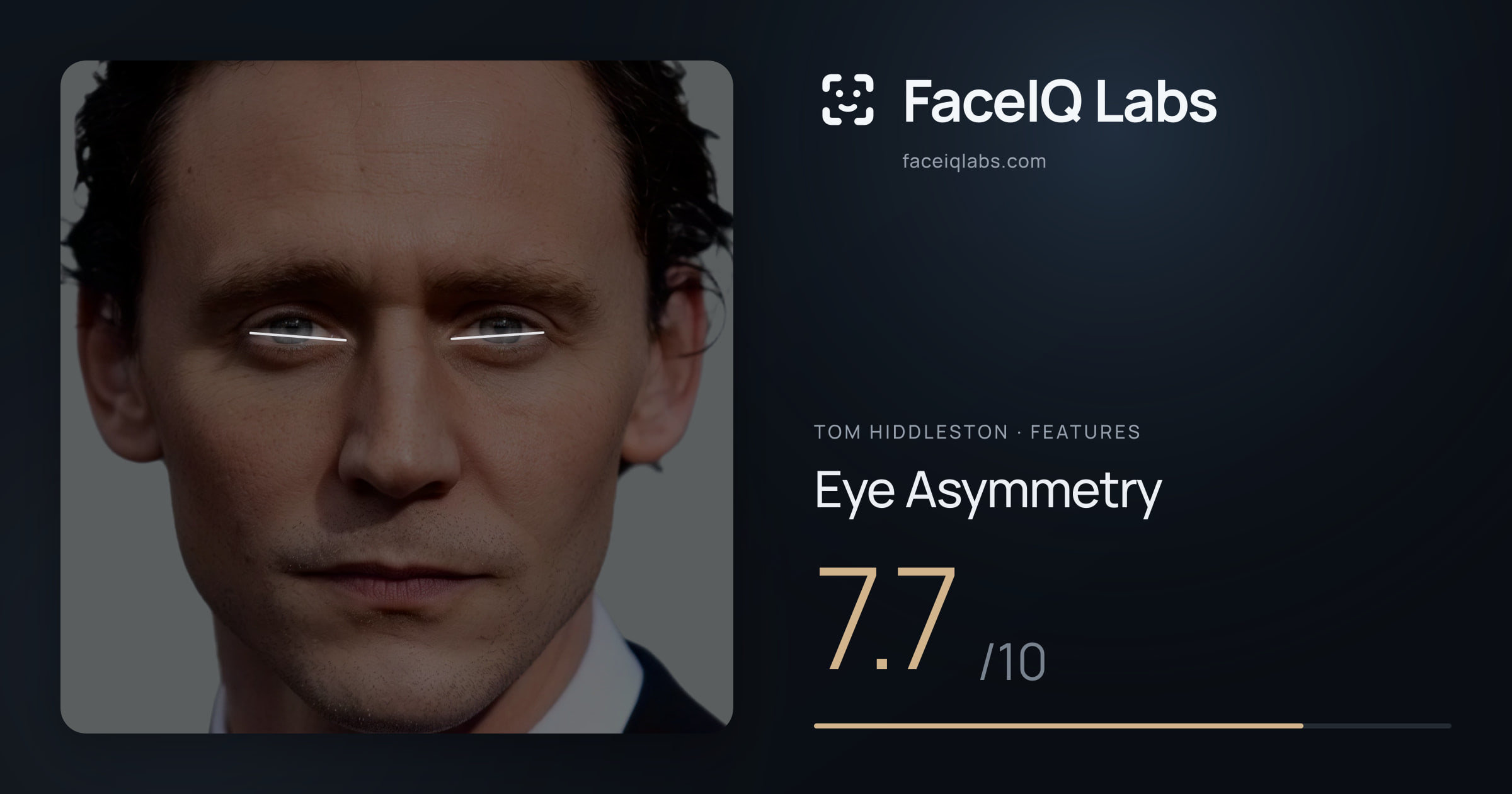 Tom Hiddleston Eye Asymmetry: 7.7/10, drawn on the photo