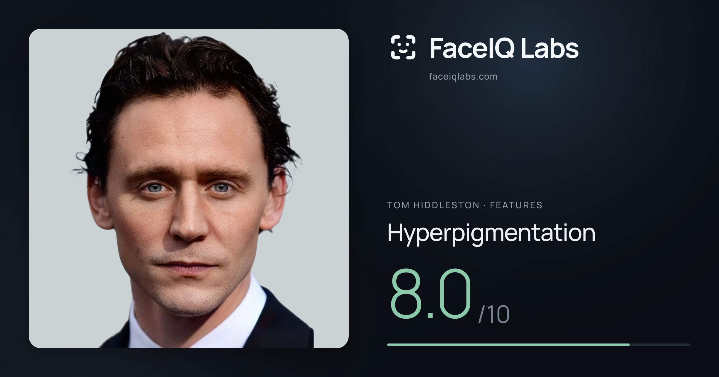 Tom Hiddleston Hyperpigmentation: 8.0/10, drawn on the photo