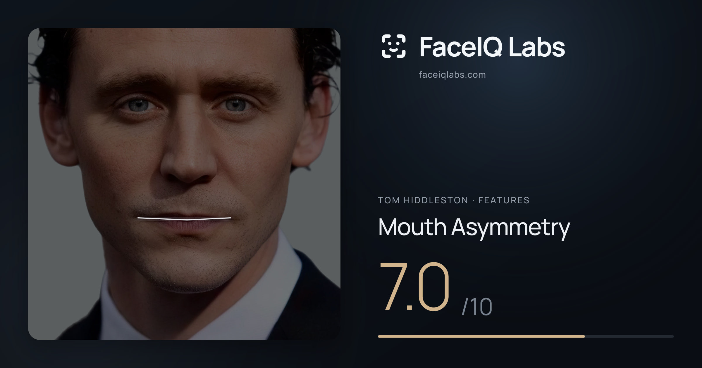 Tom Hiddleston Mouth Asymmetry: 7.0/10, drawn on the photo