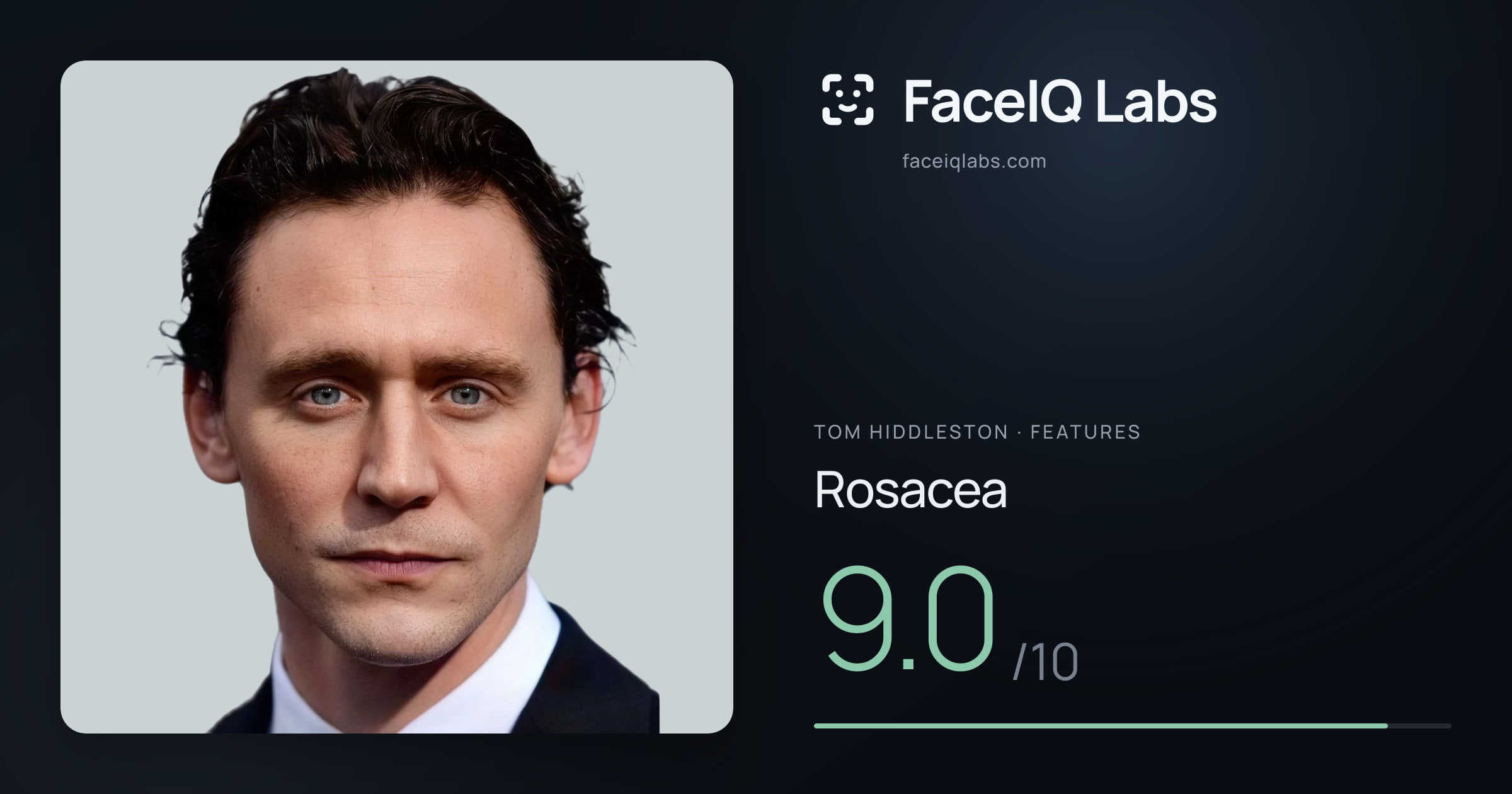 Tom Hiddleston Rosacea: 9.0/10, drawn on the photo